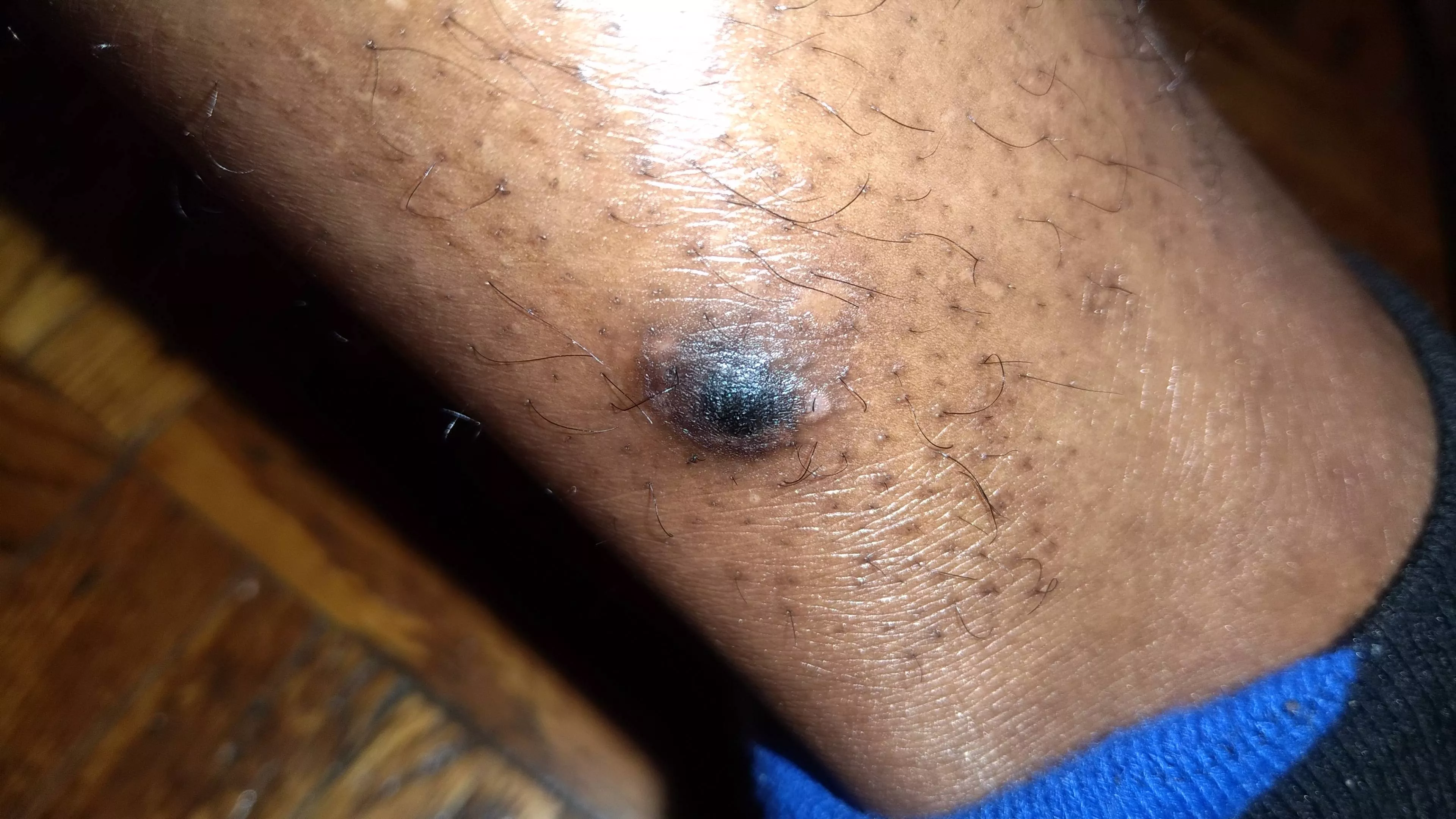 Update: Here what the bump looks like currently posted by caseyscolumbusss