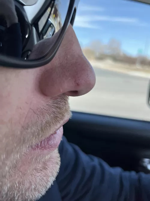 Update: Husbands nose is looking MUCH better. He started warm compresses and dove soap. by LiYuqiXIII