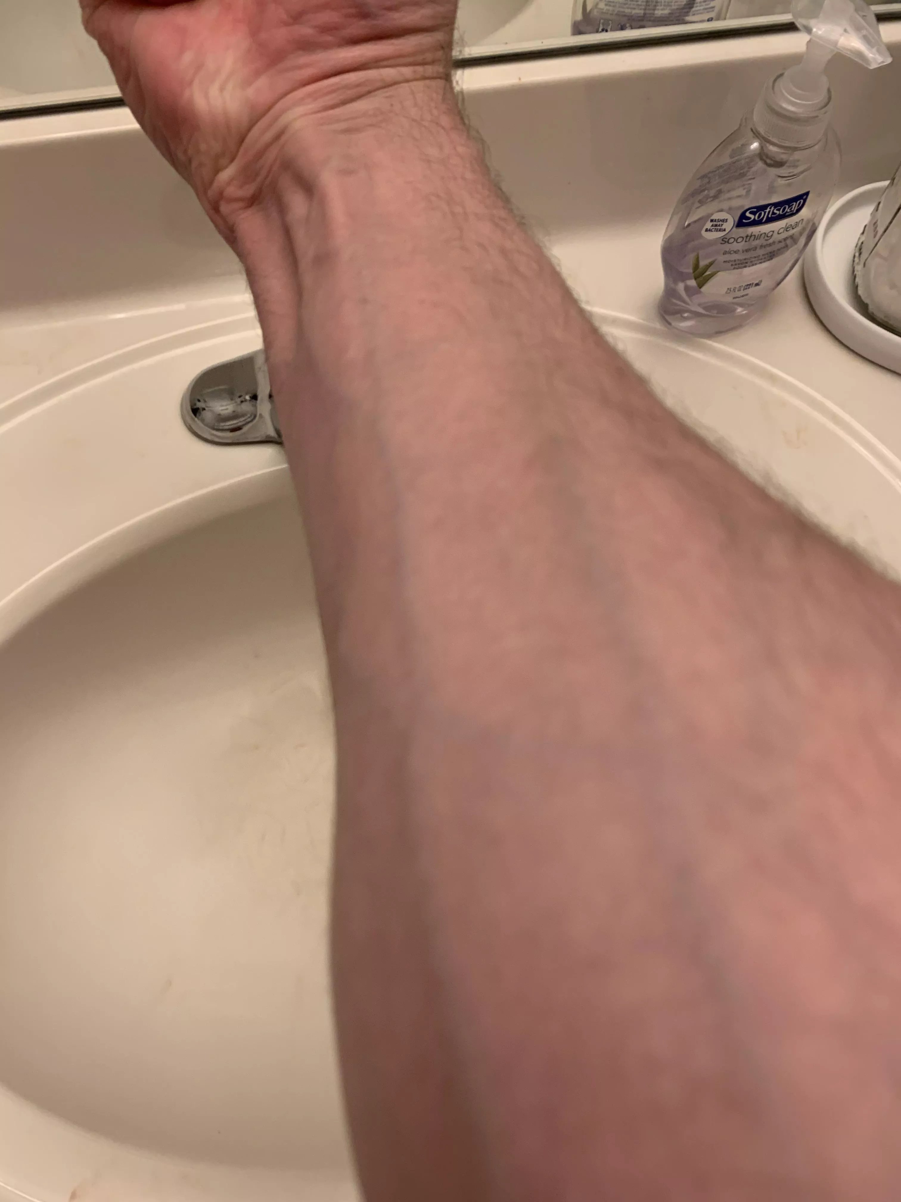 Veins posted by AlligatorSlate
