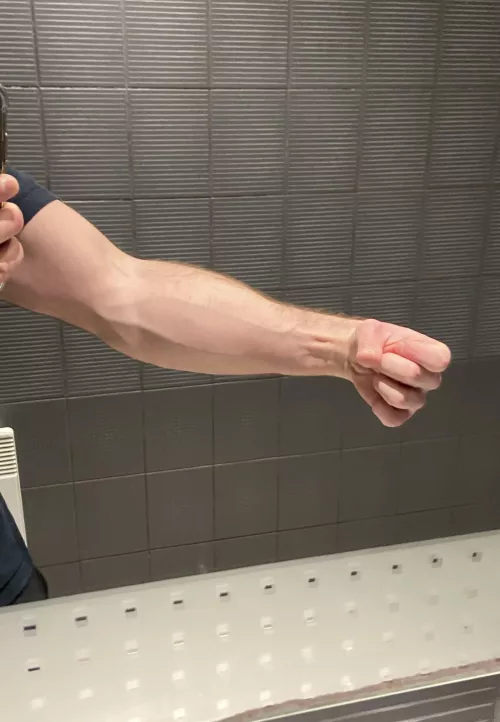 Veins checkup by AlphaMen007