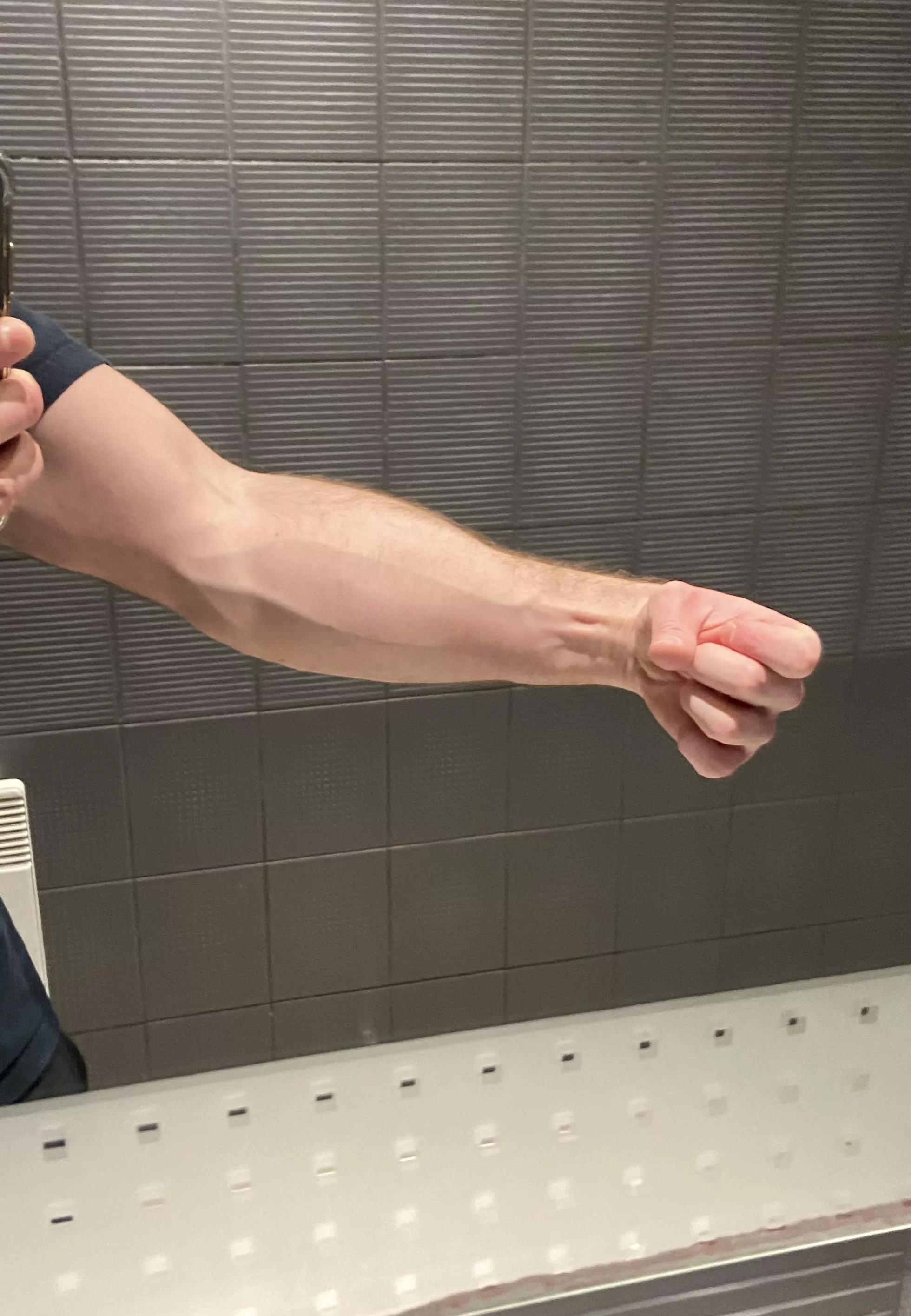 Veins checkup posted by AlphaMen007