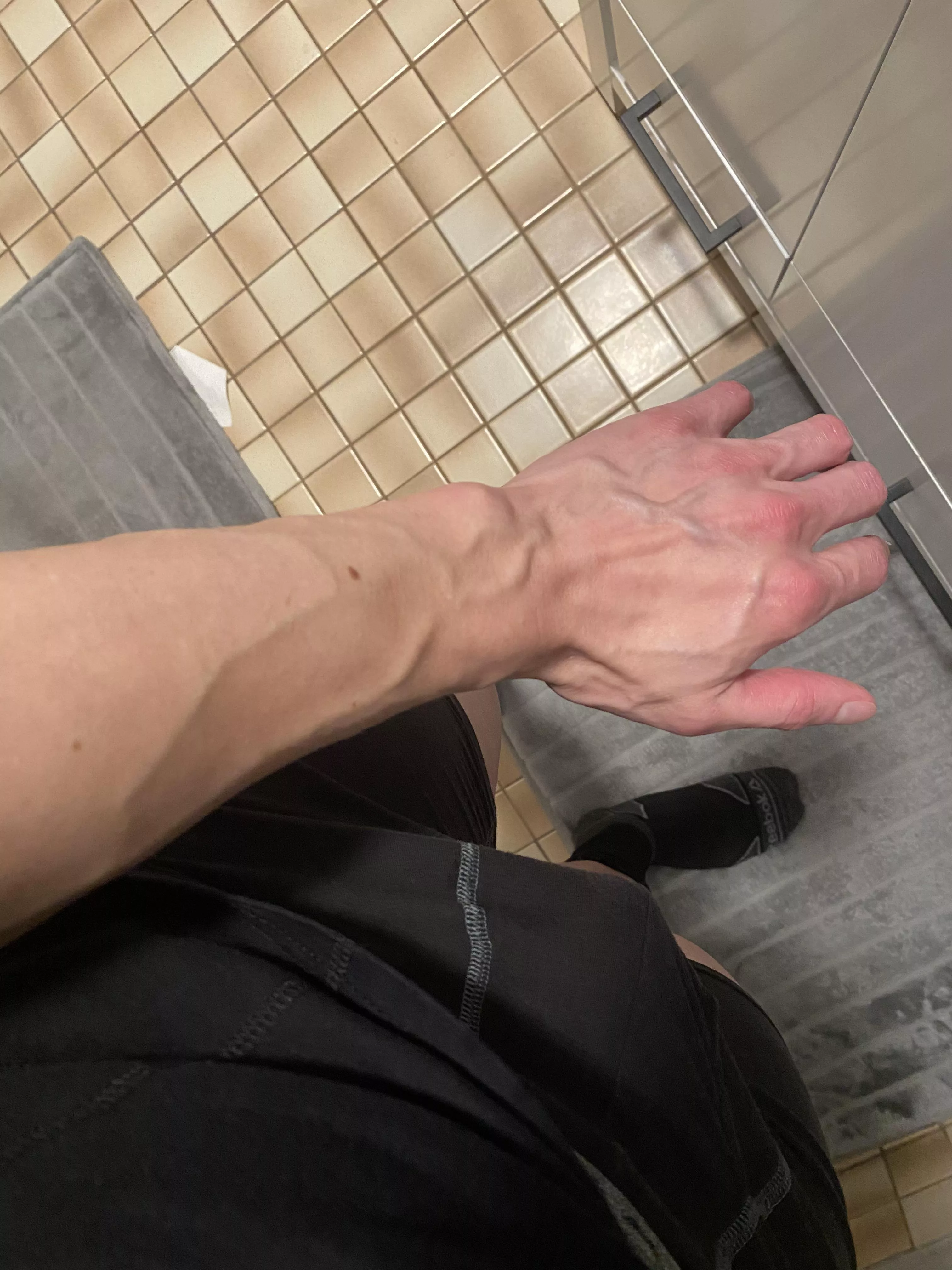 Veinssss posted by heywhatsup3399