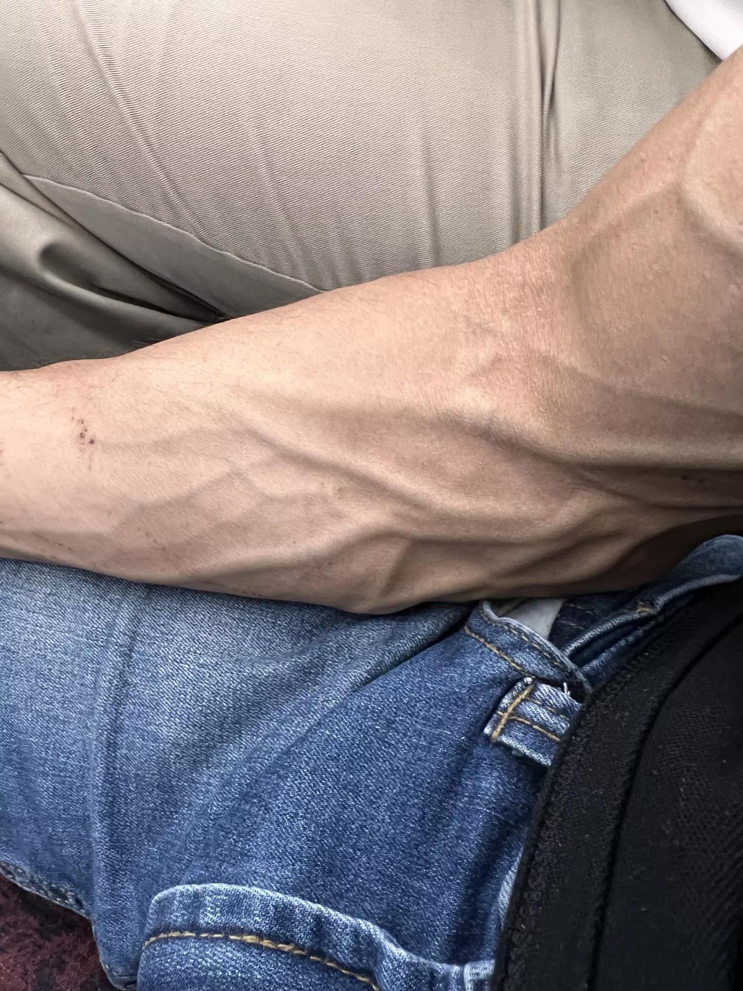 Veinstacular! posted by Wingdingdong