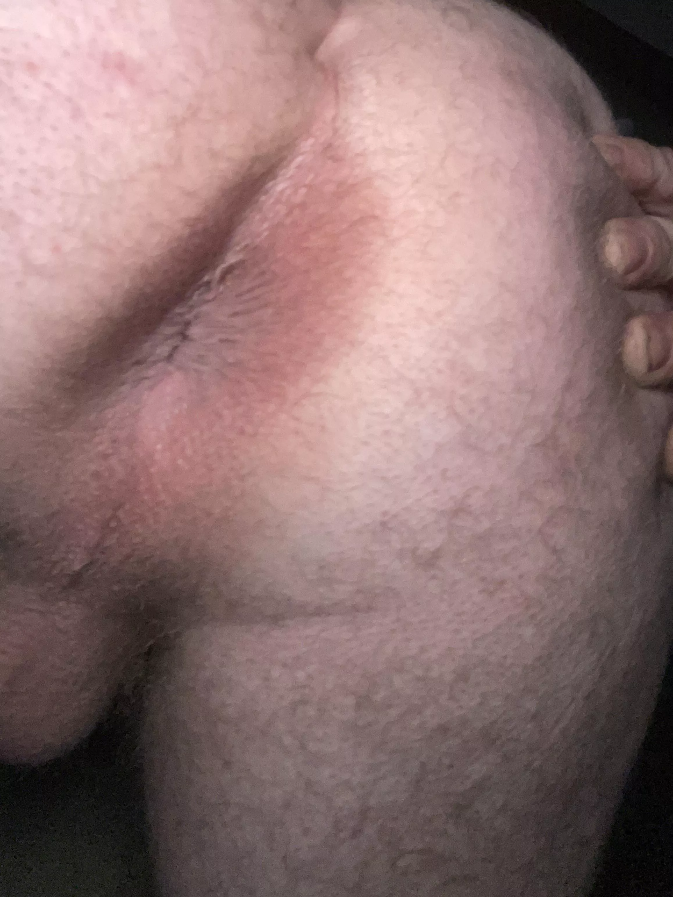 Virgin hole posted by MatterFluid2659