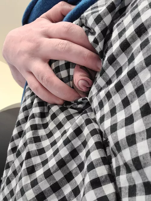 vitiligo big clit by VitiligoFtMboi