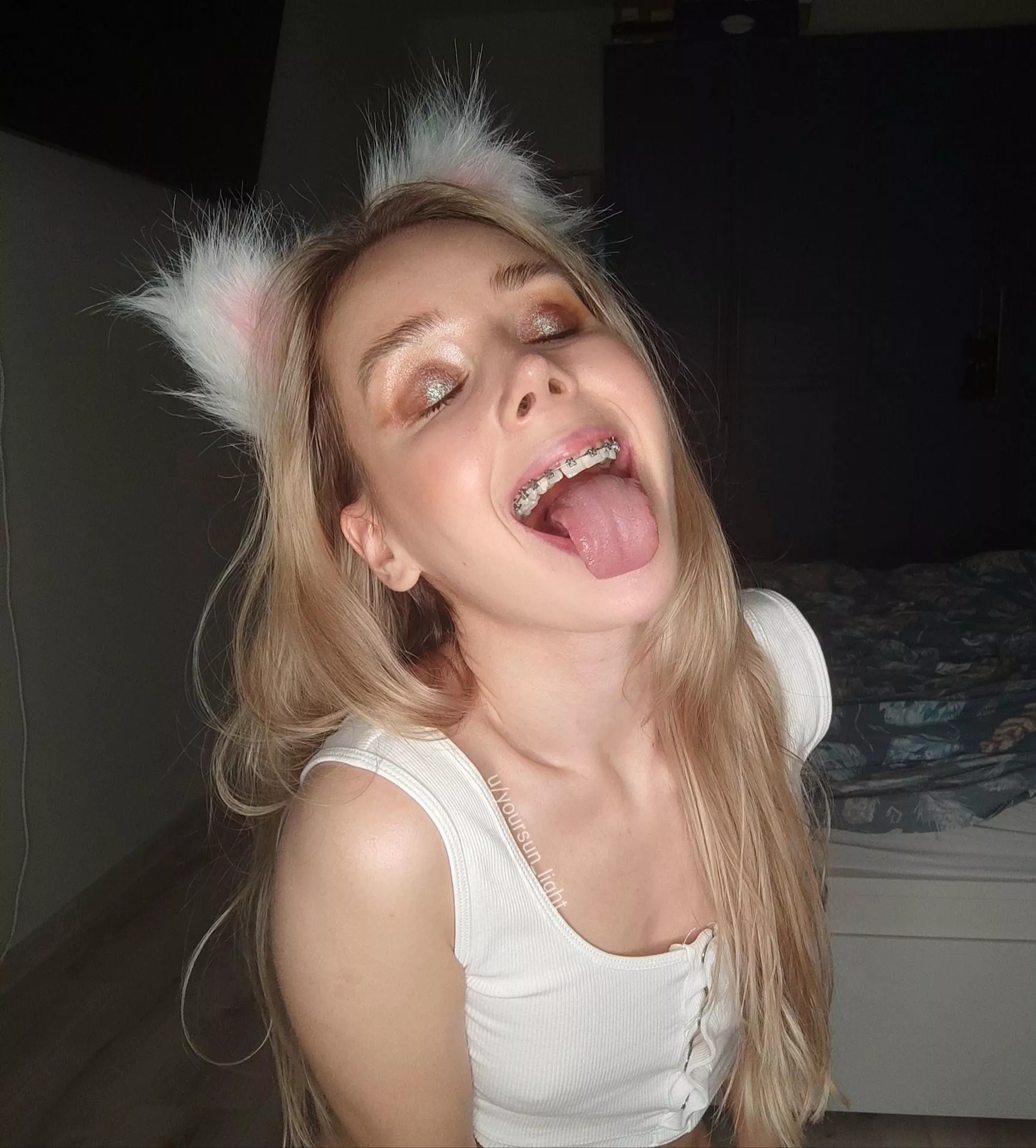 Wanna cum on my braces? posted by yoursun_light