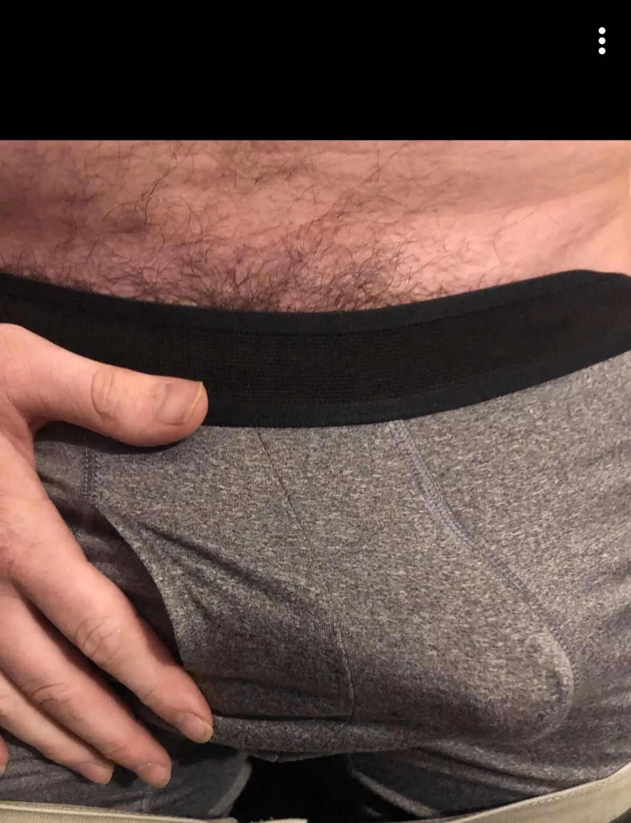 Wanna see more DM’s are open. posted by Time_Atmosphere1062