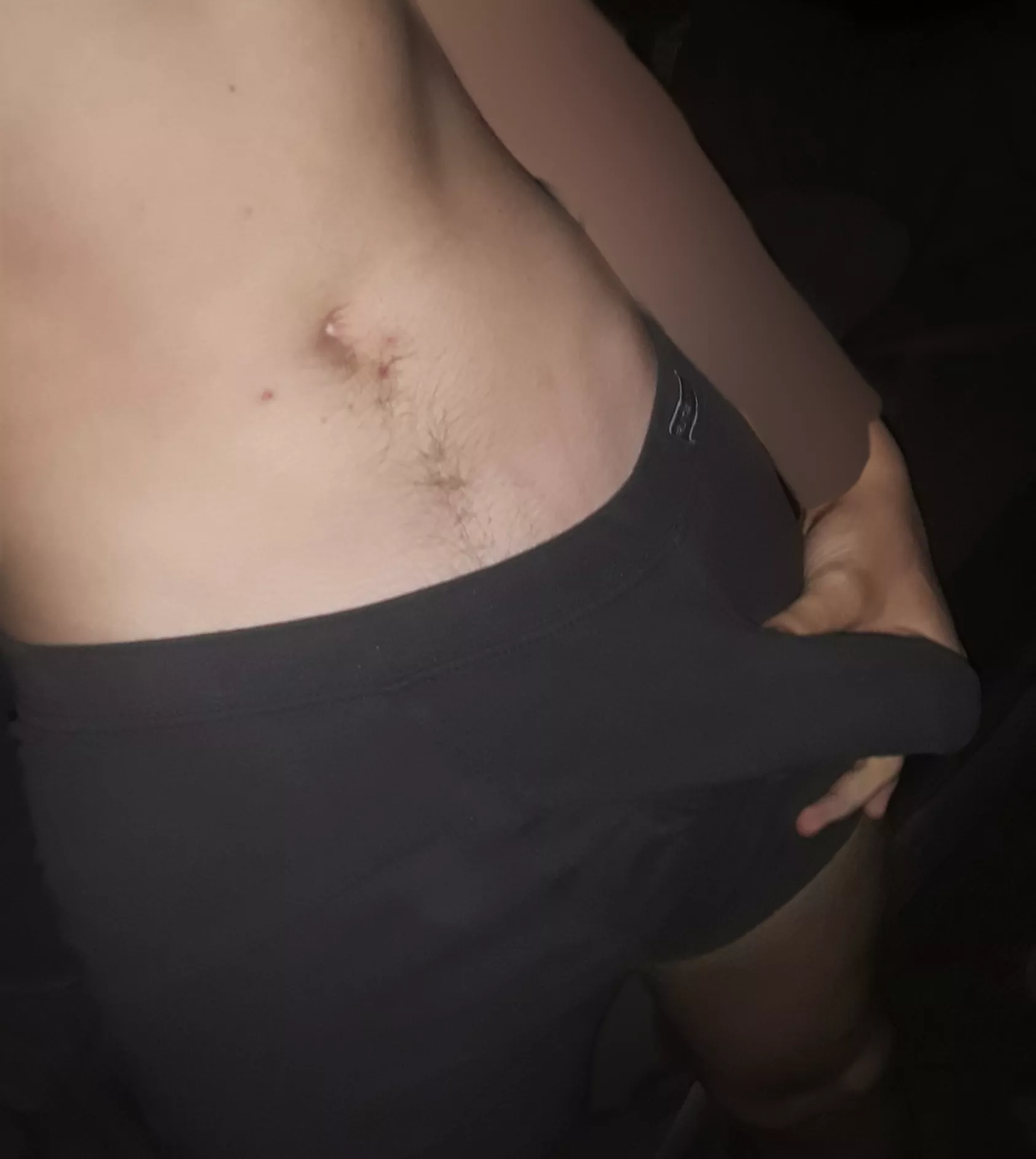 wanna see what's underneath? posted by not-important-yet-01