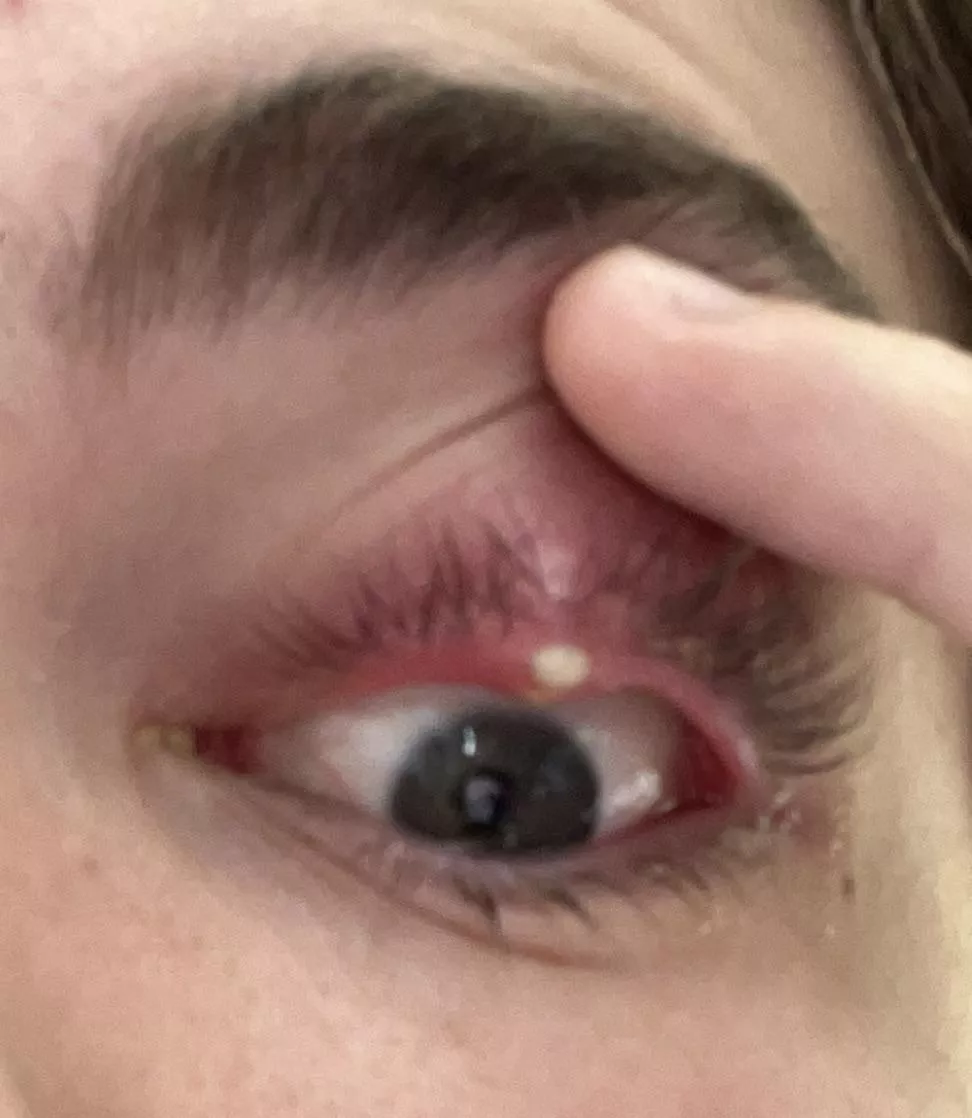 Week old forbidden pop posted by MatBlyat