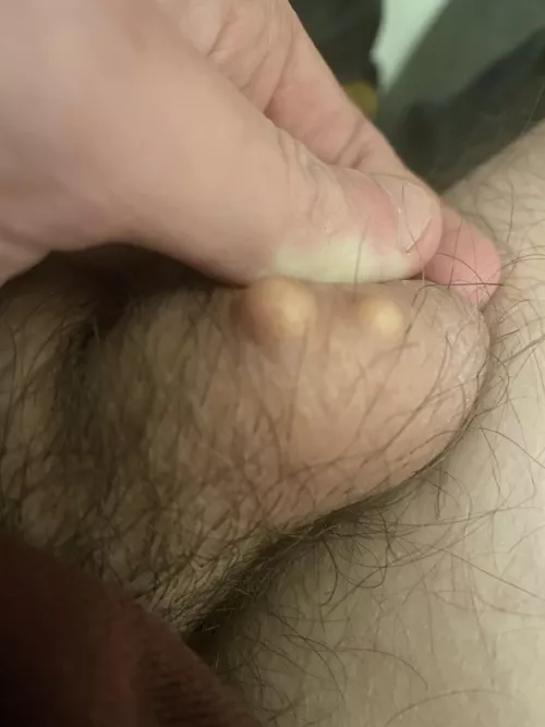 Went to the doctor as recommended by everyone in this post. Some people wanted an update so for anyone wondering, they are just cysts and harmless. Check your balls guys. by throwaway101010233