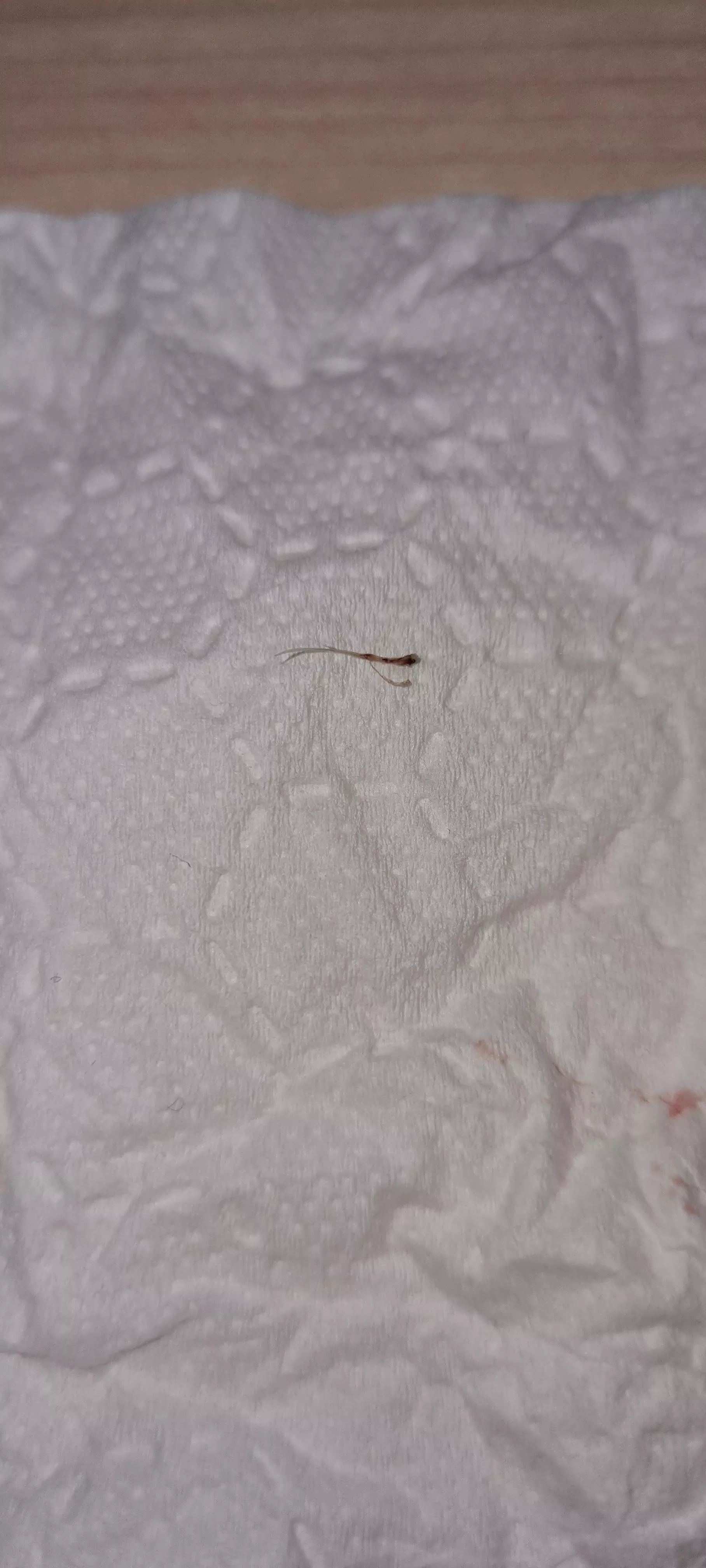 What do you call this? It just came out of the back of my head and now it won't stop bleeding. posted by Pikeyyyy