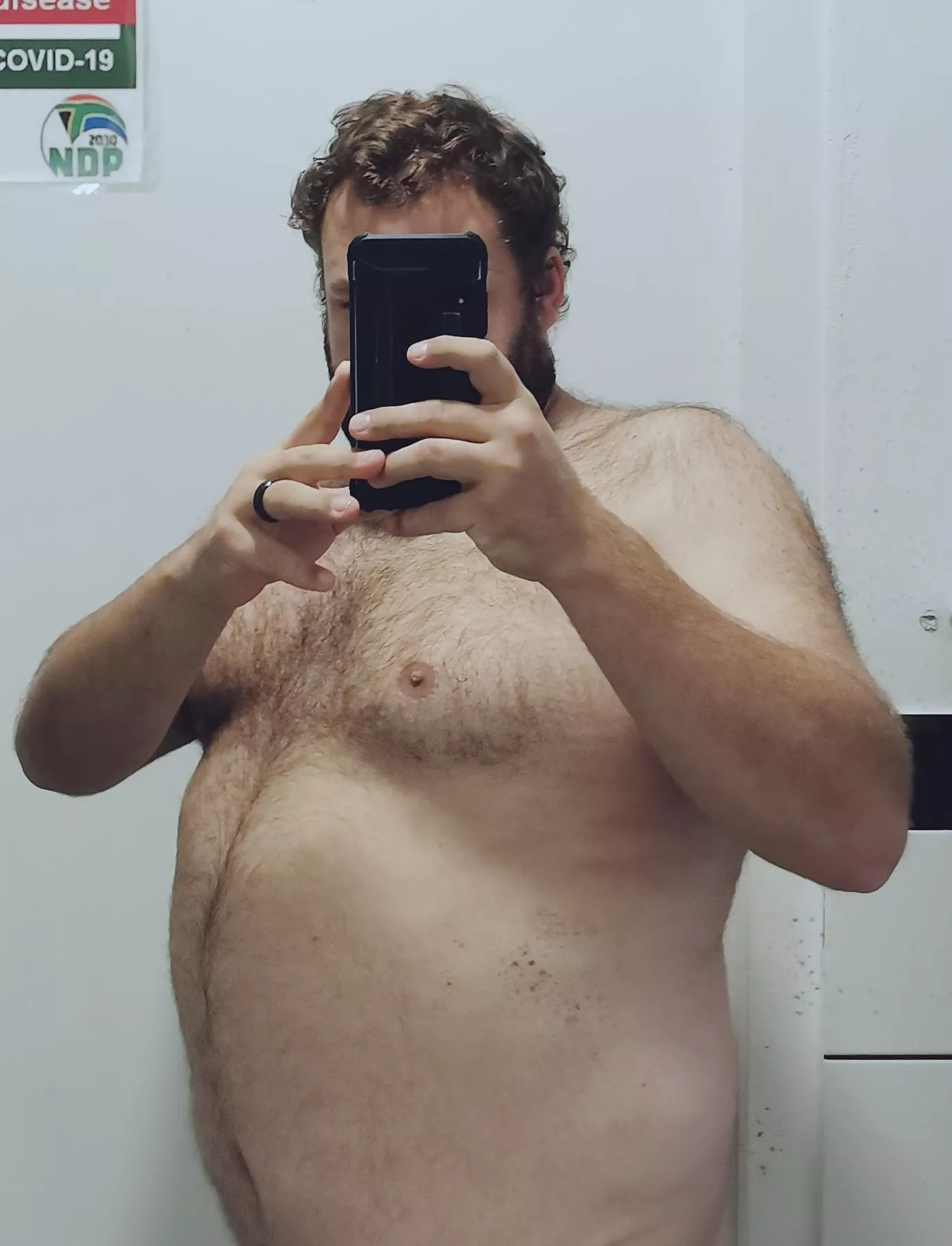 What do you guys think? I'm usually insecure about my body 😊 posted by ScarBearZA