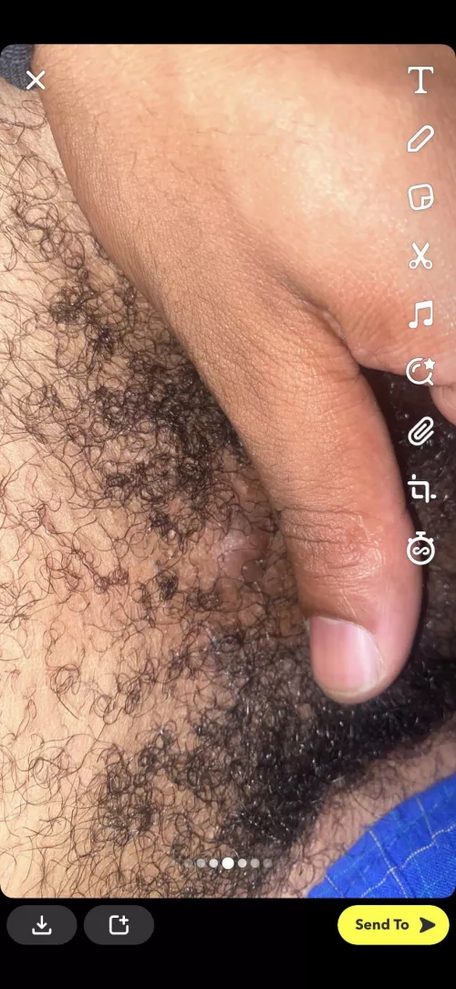 what is this? been here for a minute now cyst? by JustJeff23