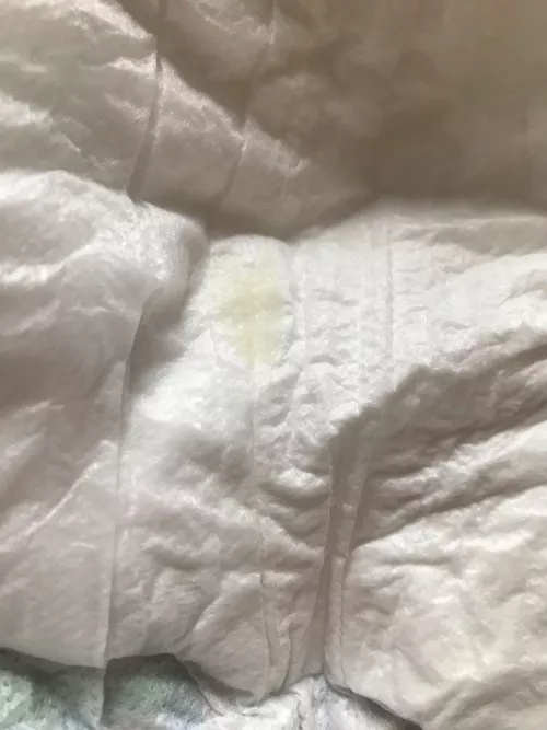 What is this? I found it on the inside of my diaper. by throwaway_number_idk