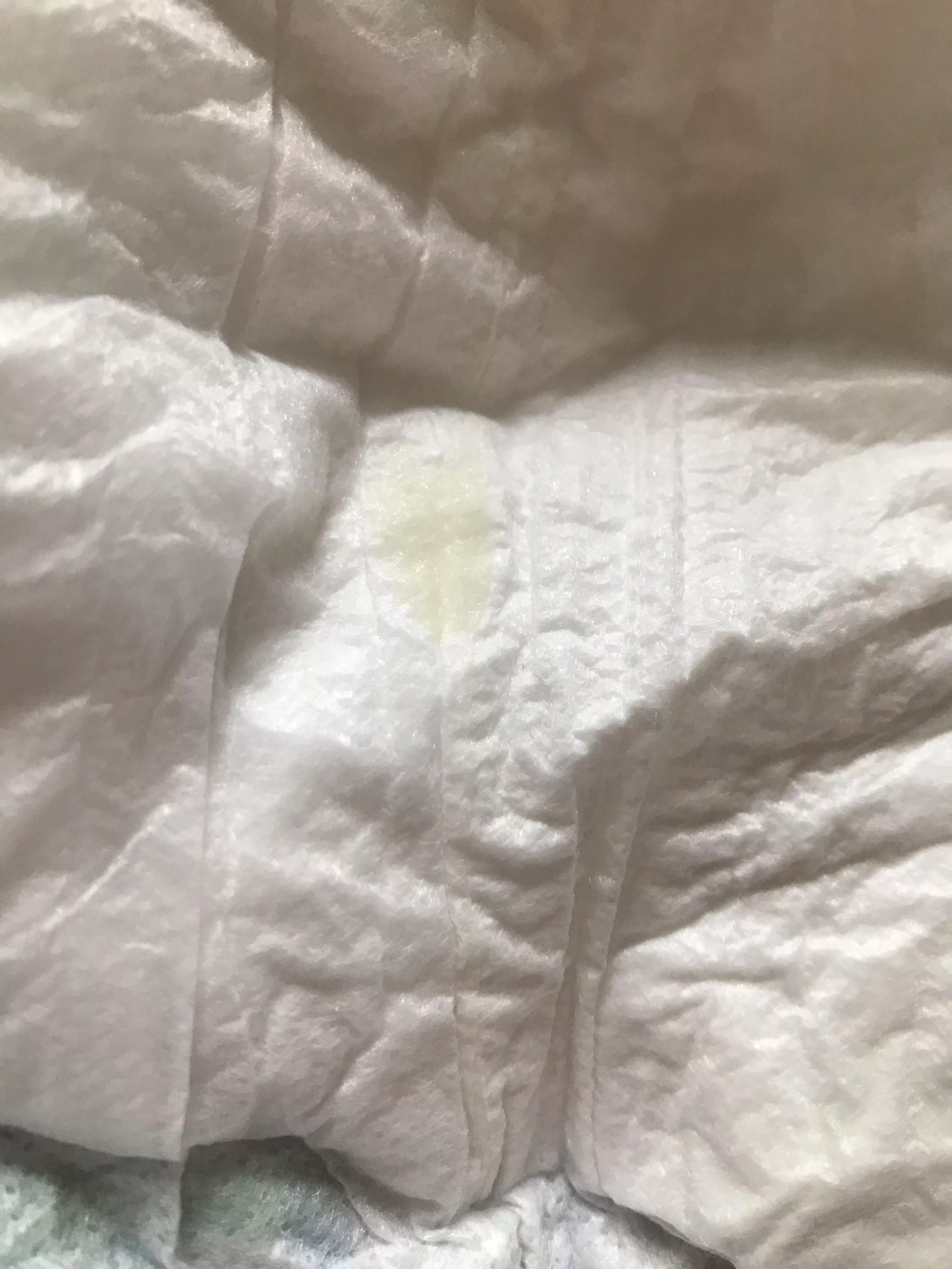 What is this? I found it on the inside of my diaper. posted by throwaway_number_idk