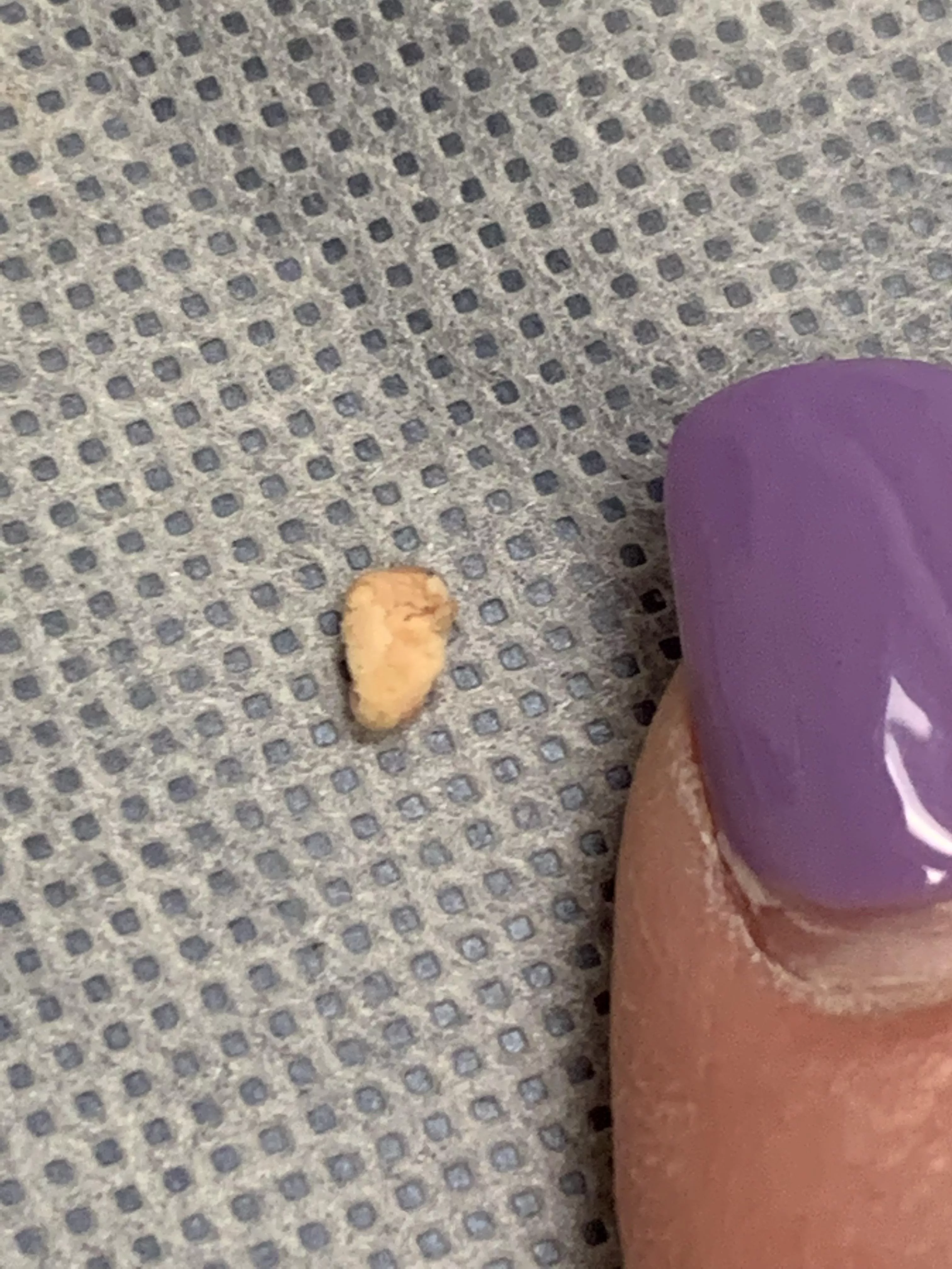 Whatever this is that blocked my Bartholin’s abscess from draining. No video. I was trying not to vomit because of the pain. posted by HeroaDerpina