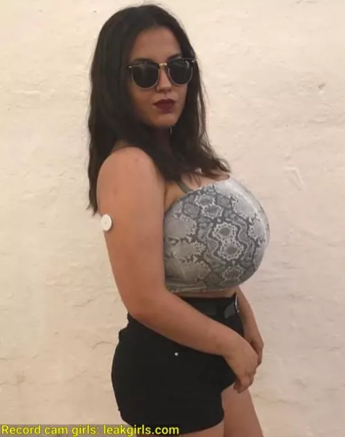 what's og her arm? by escapeclaws