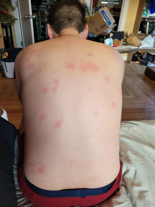 When you let your girlfriend go to town on your back by Woodhouse_20