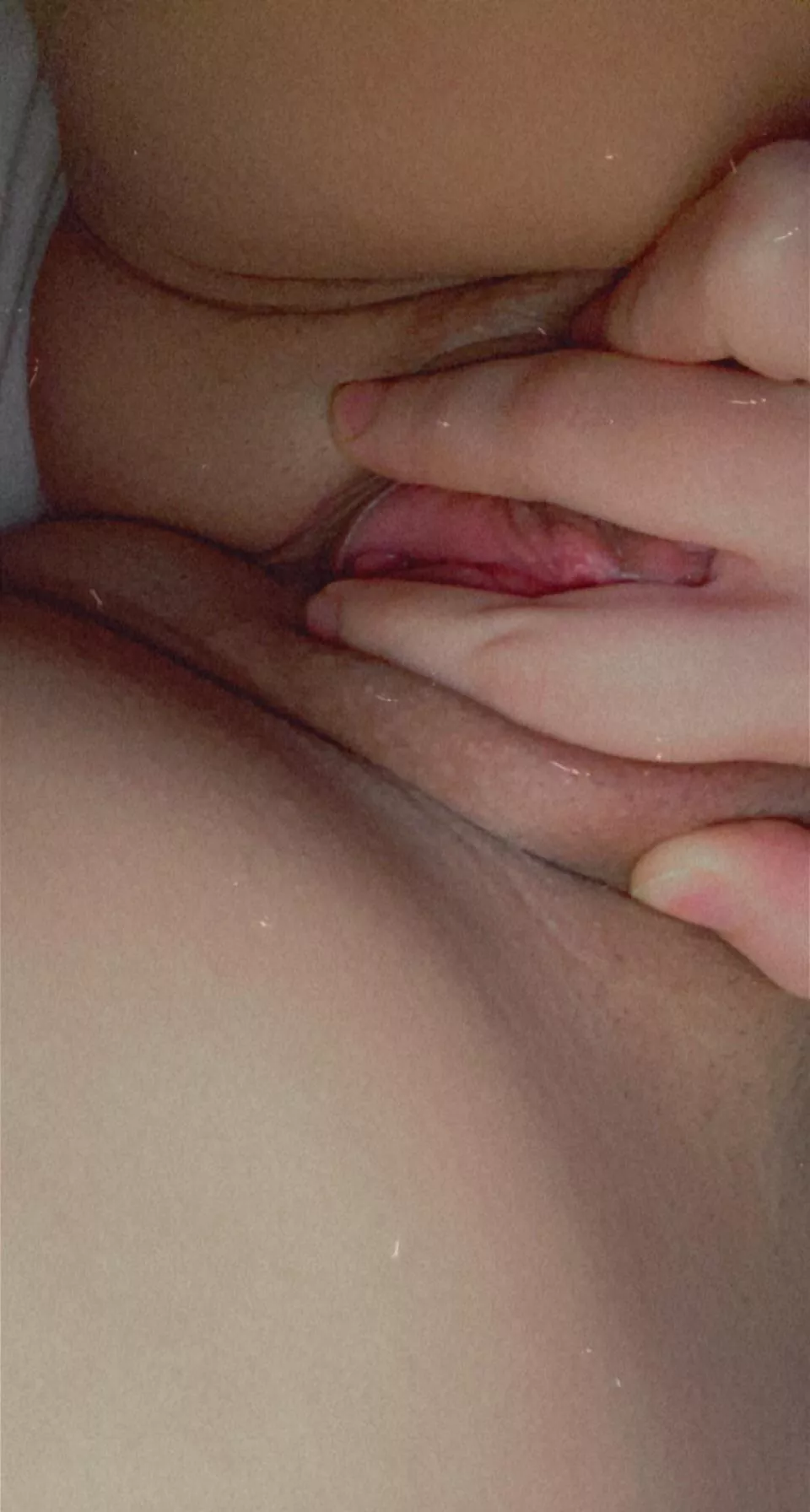 Who can eat this for me (f) posted by Fair-Set9347