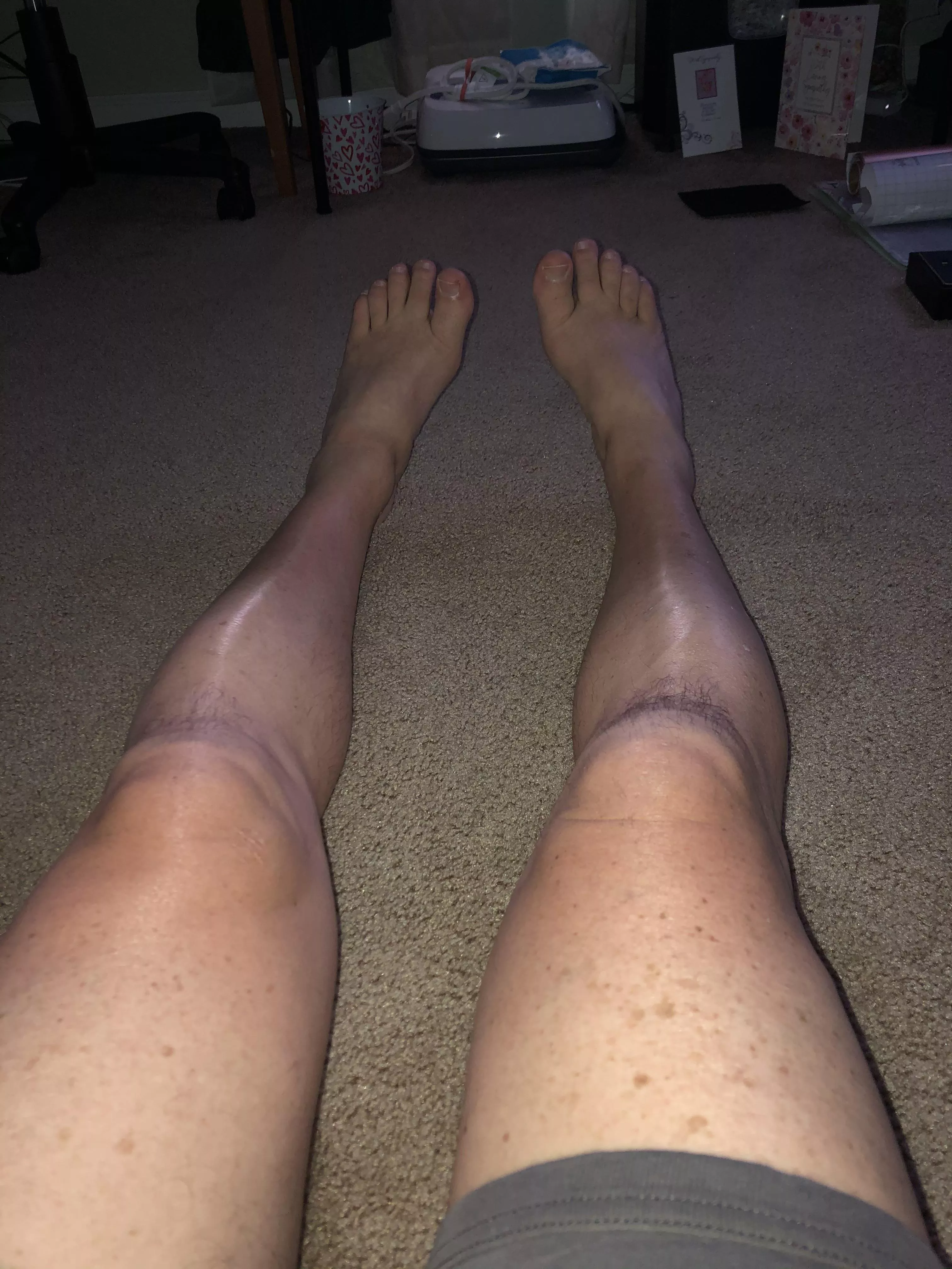 Who wants to worship these 65 year old feet ? posted by Fit_Ad5248