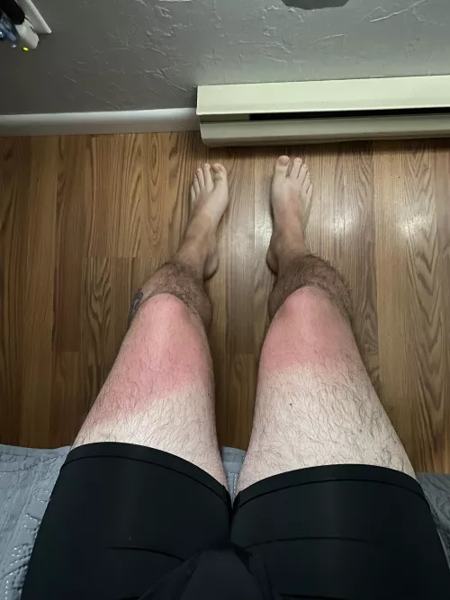 Who wants to worship these feet and rub lotion on my sunburn 🥵 by Kennyfux