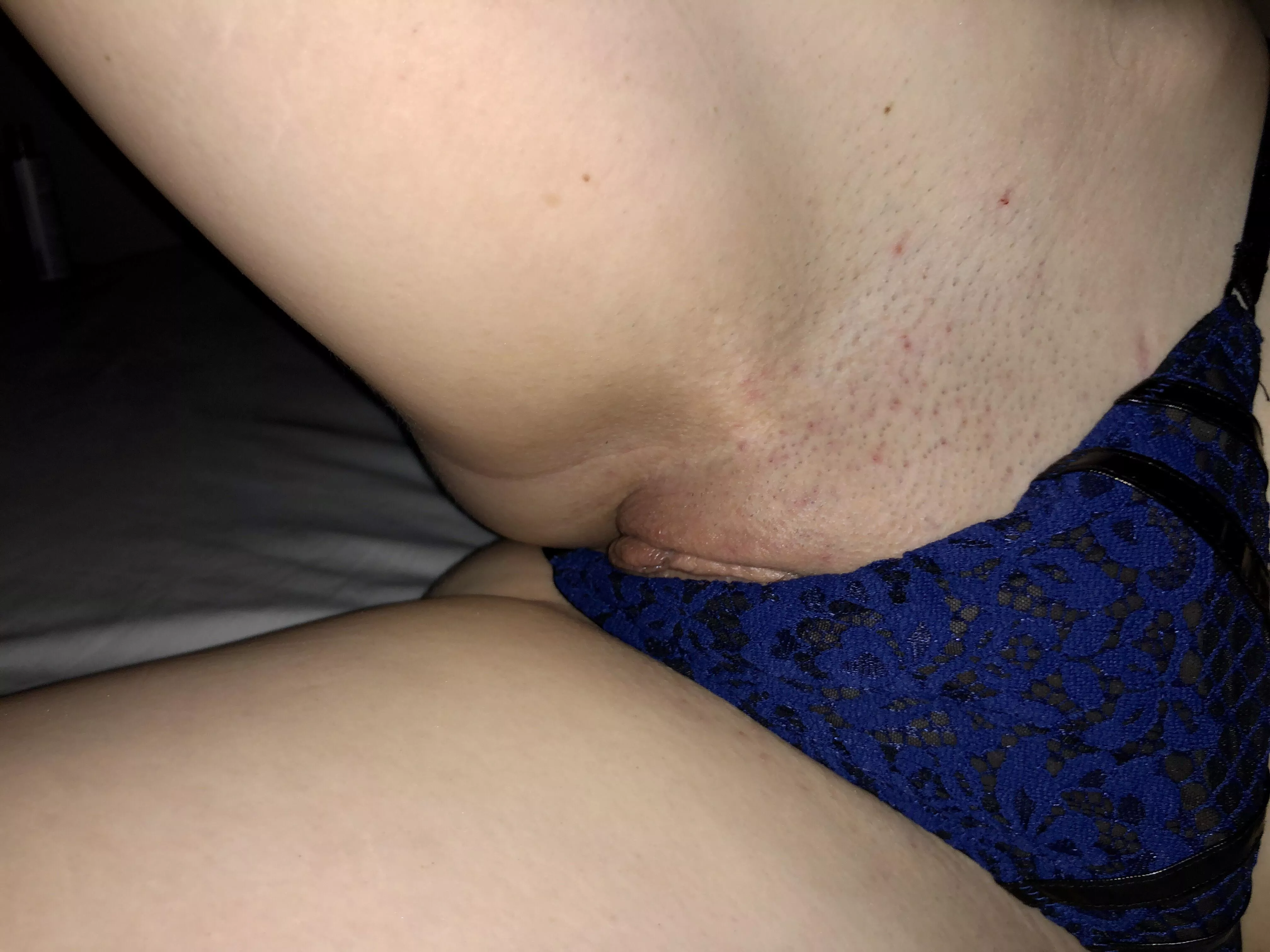 Whoops posted by NuttyBuddy69_OF