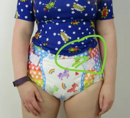 Why am i leaking, i always leak in a maybe half full diaper at the circled part and runs down the side (where the arrow points) it seems like the pee travels up and is not absorbed fast in this part of the diaper, am i taping wrong? Is my diaper to big/t by sissy112244