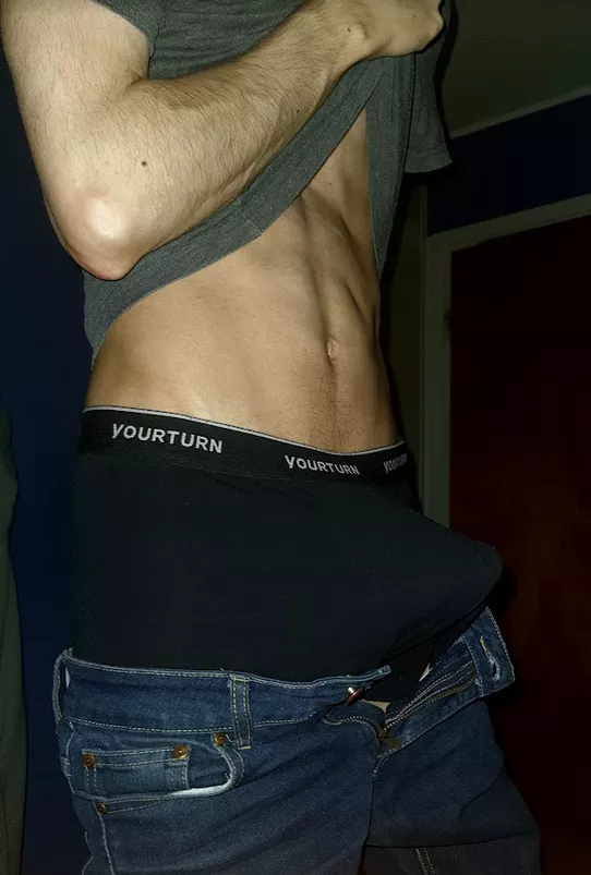 woops posted by MasterpieceNo6802