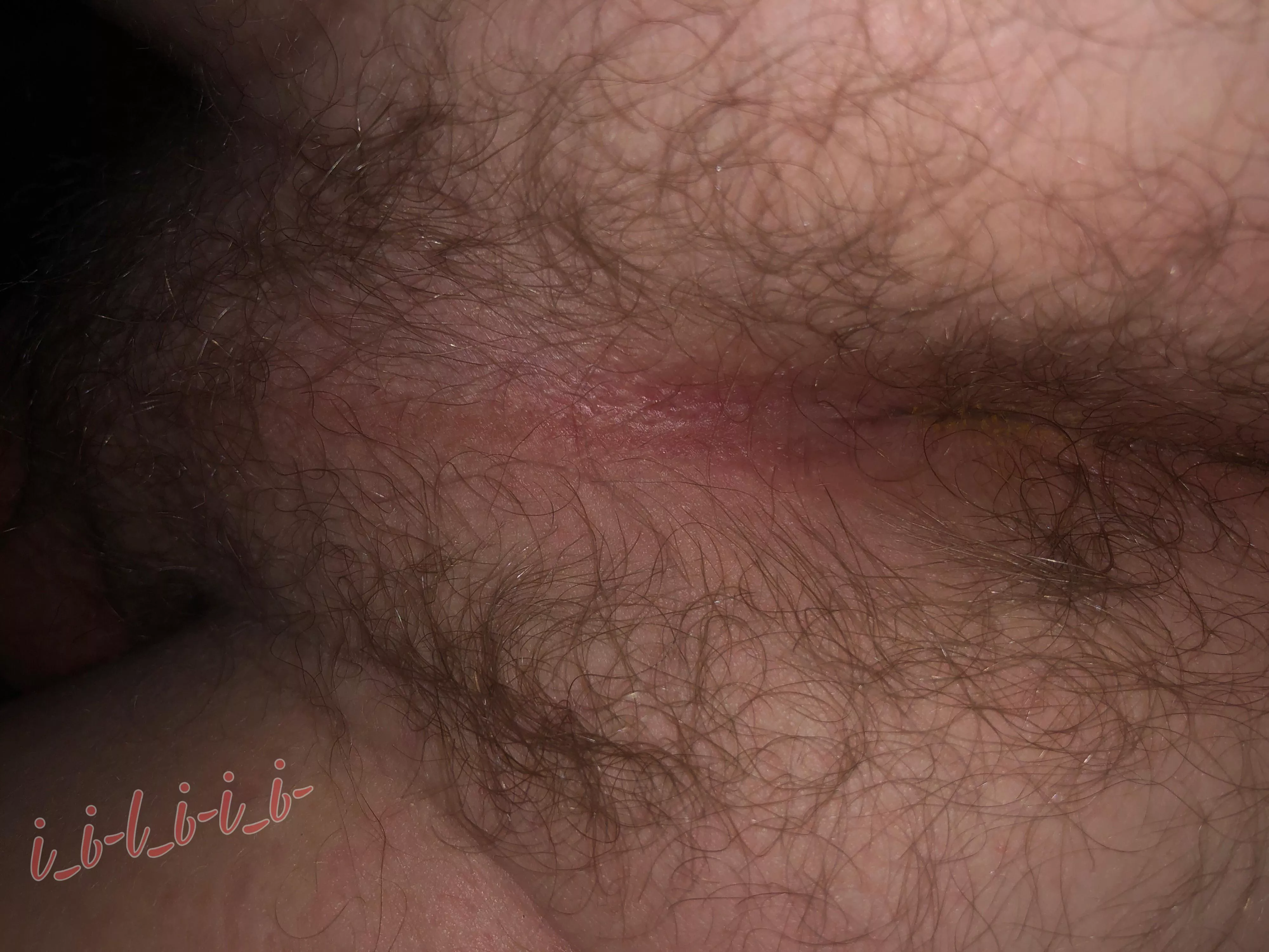 Would you fill my hole? posted by i_i-I_i-i_i-