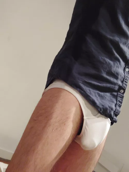 Would you stare? by Ok-Enthusiasm-4179