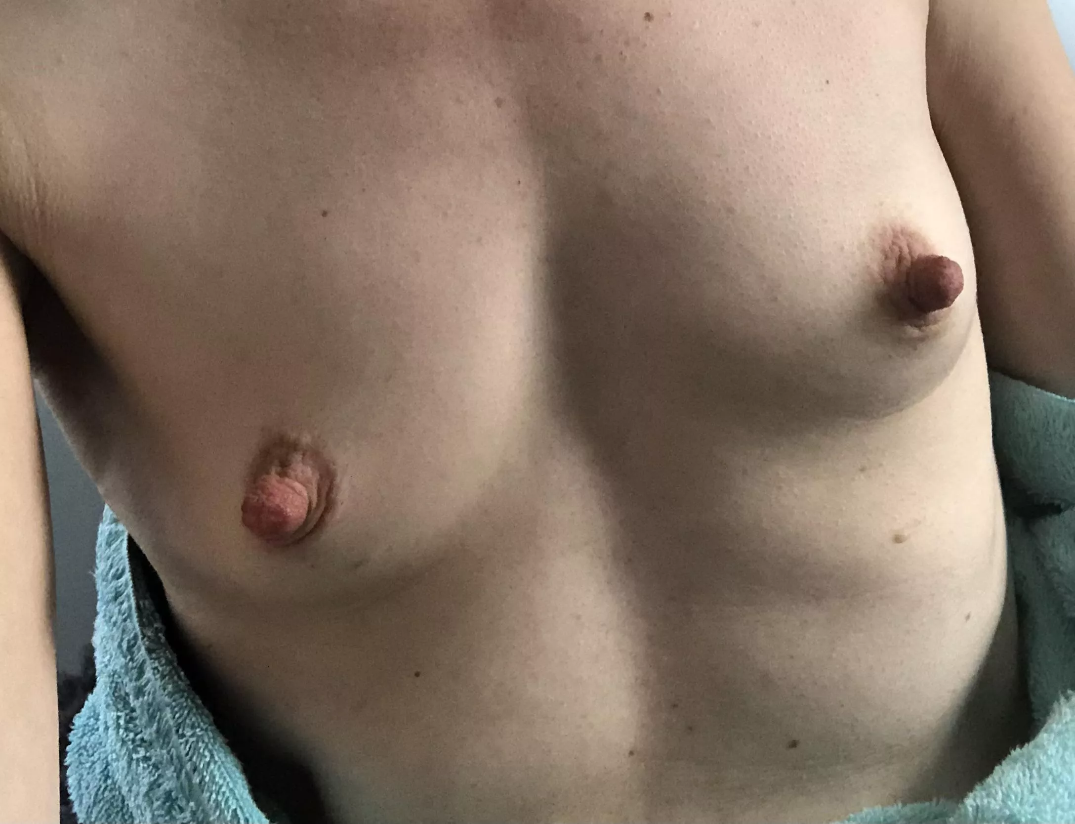 Would you touch them? posted by Monkeys428