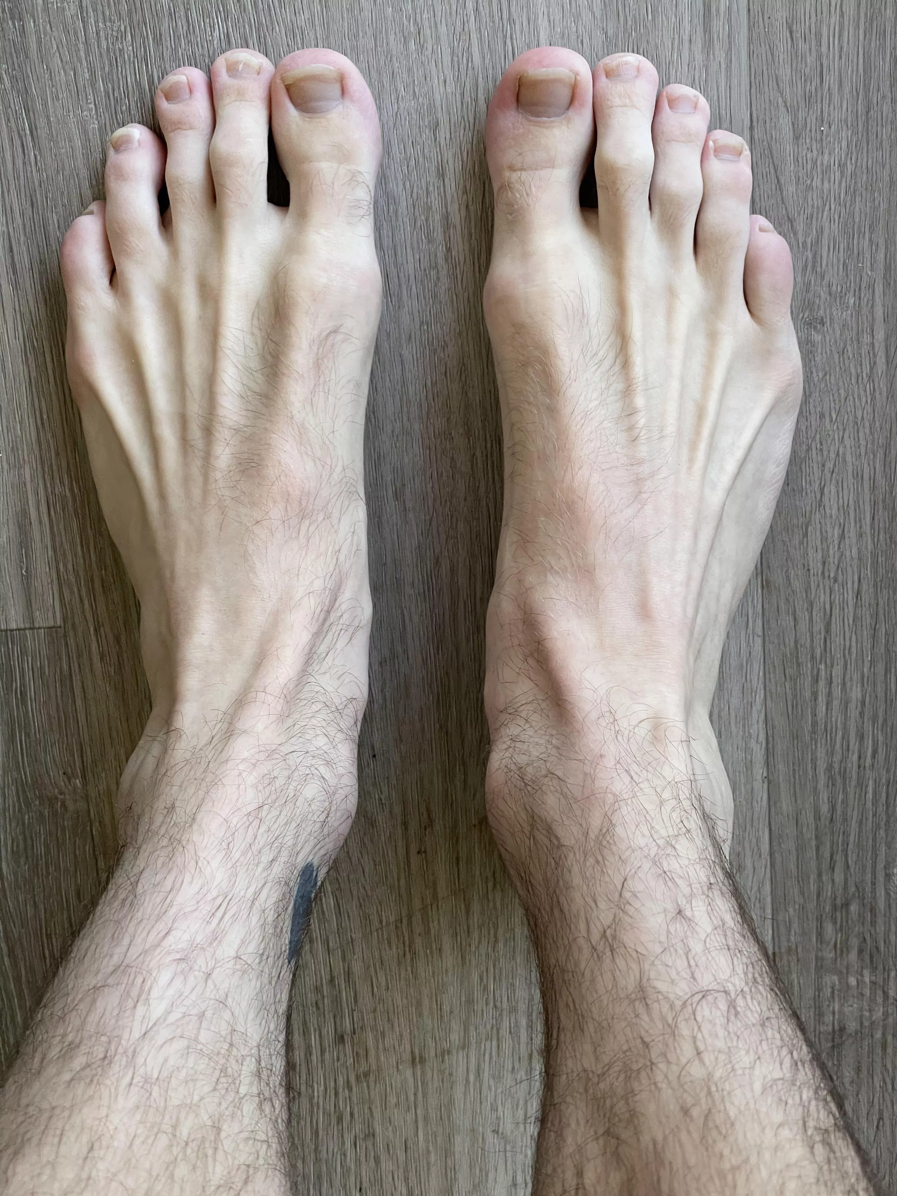 Would you worship my perfect feet? 😛 posted by aceheartbreak