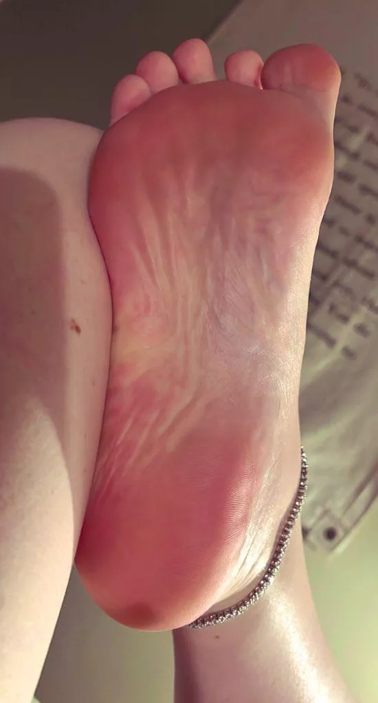 Wrinkle posted by Minimum_Builder3763