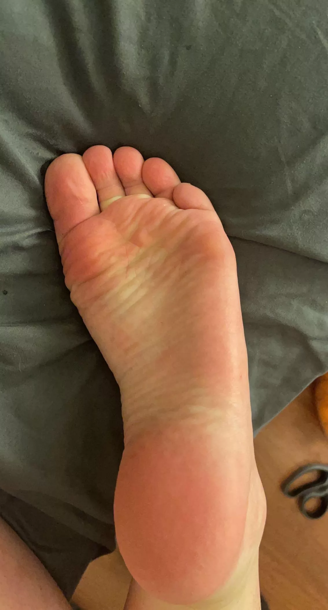 Wrinkles posted by lilkitten0725