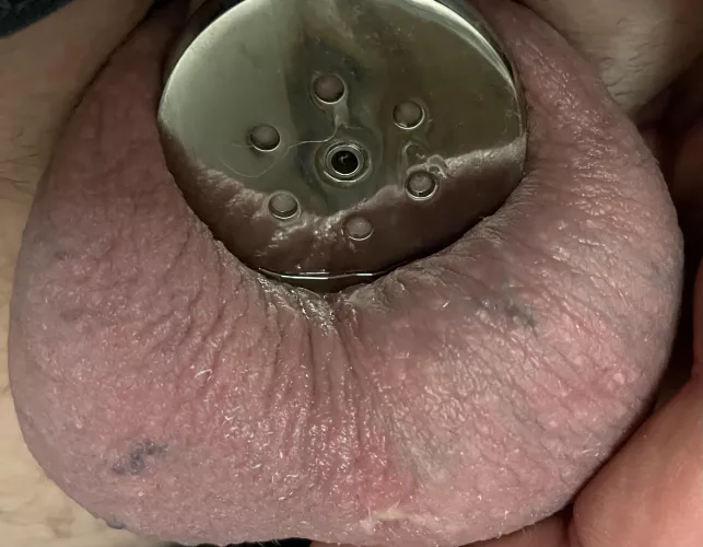 You can see the urethral tube in the middle. by 581-130-414