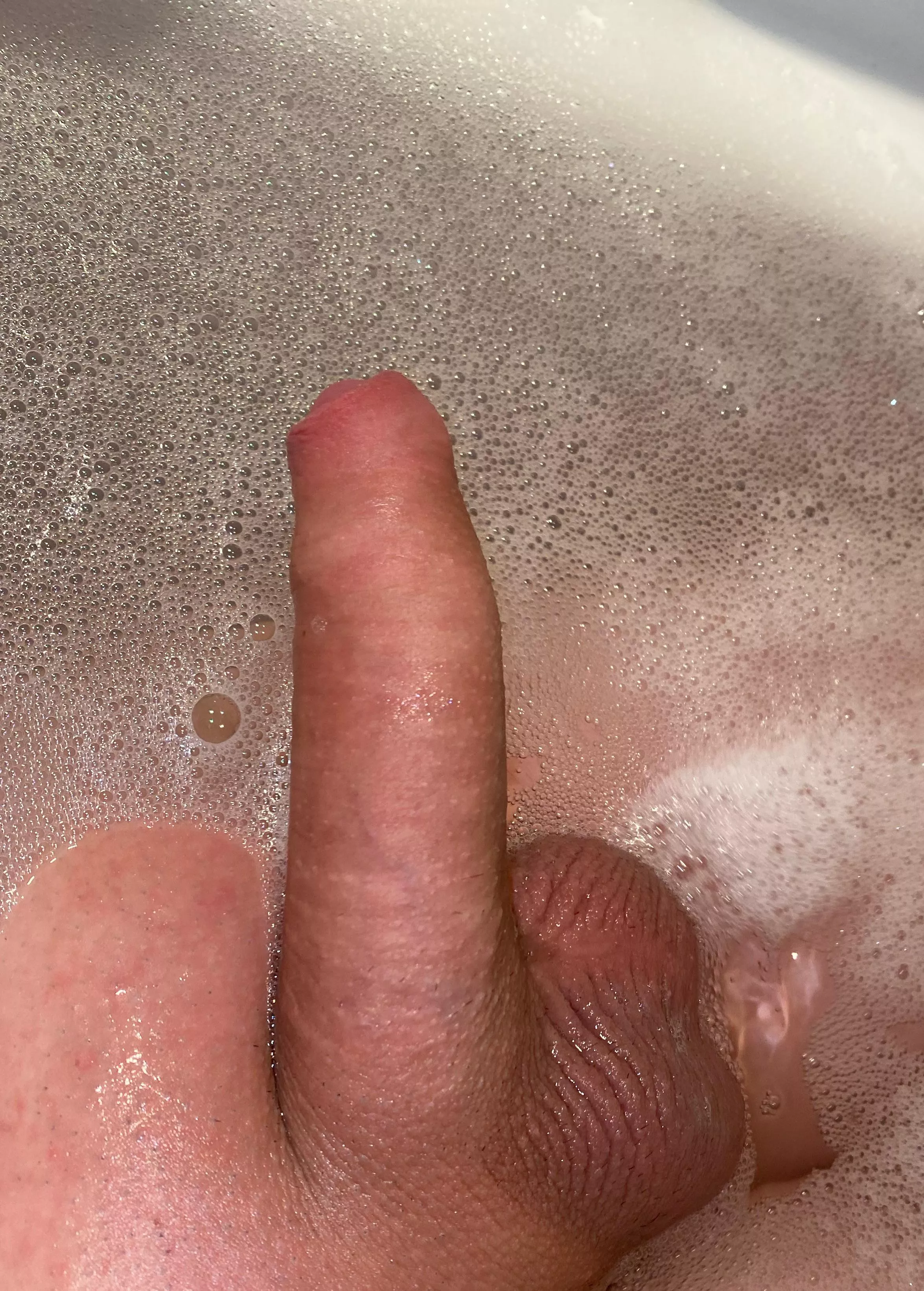 my foreskin in the bath posted by whythis016