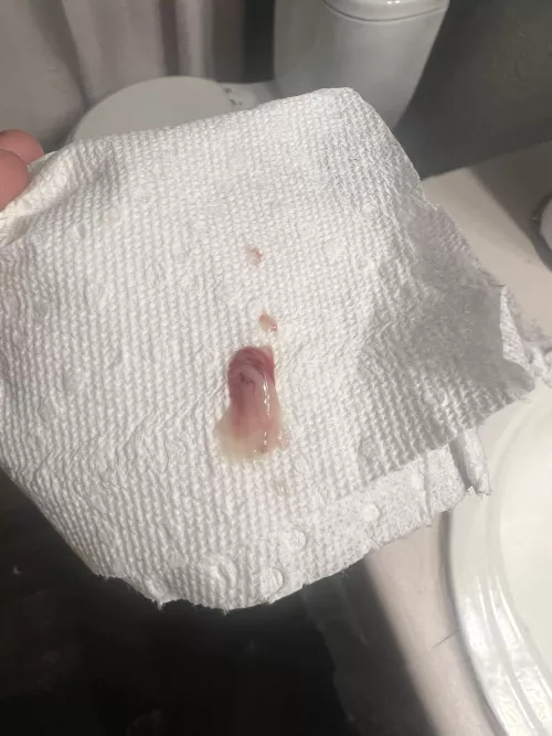 Pop from boyfriends thigh by MediumSuspicious8336