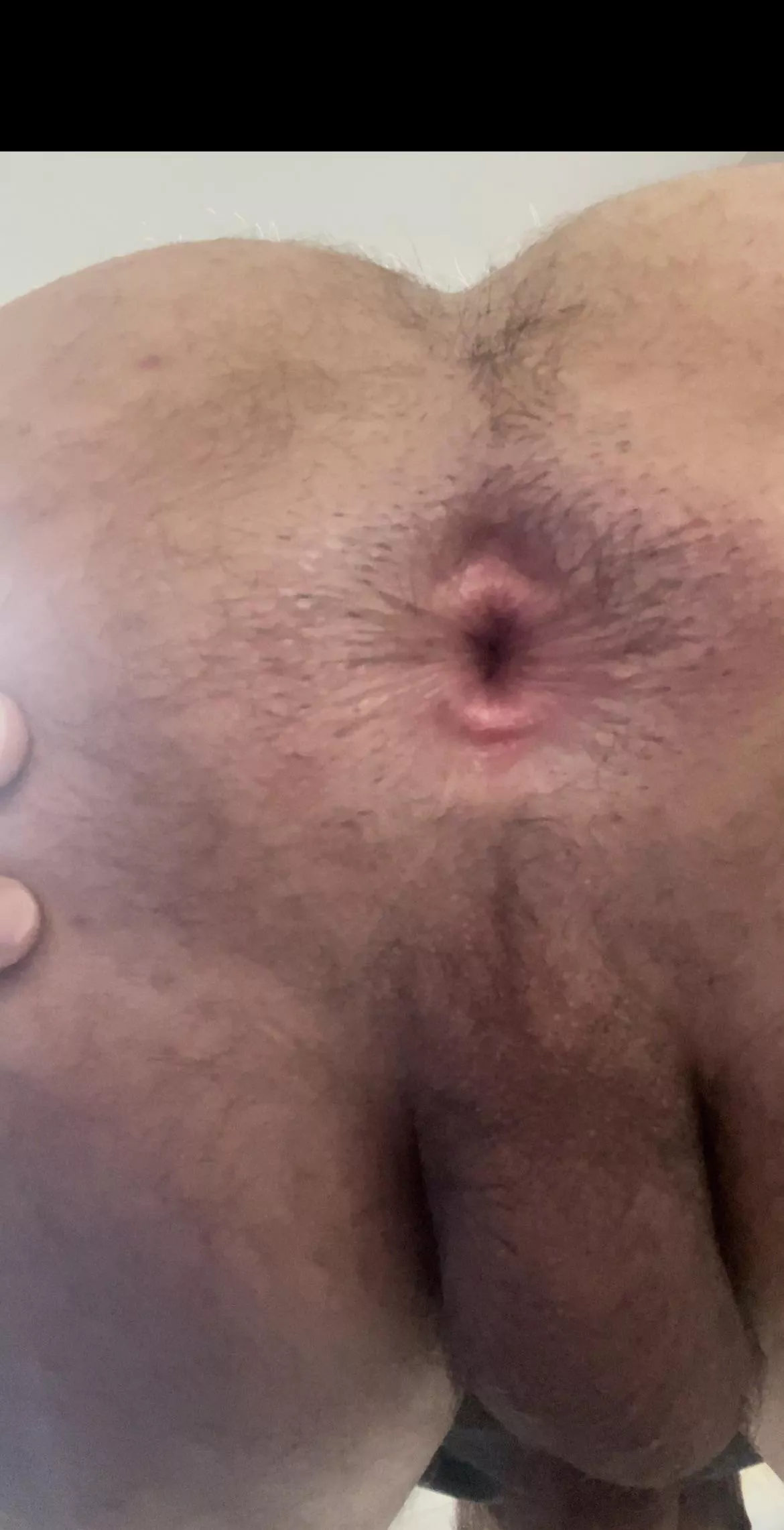 My small gap posted by Disastrous_Party_456