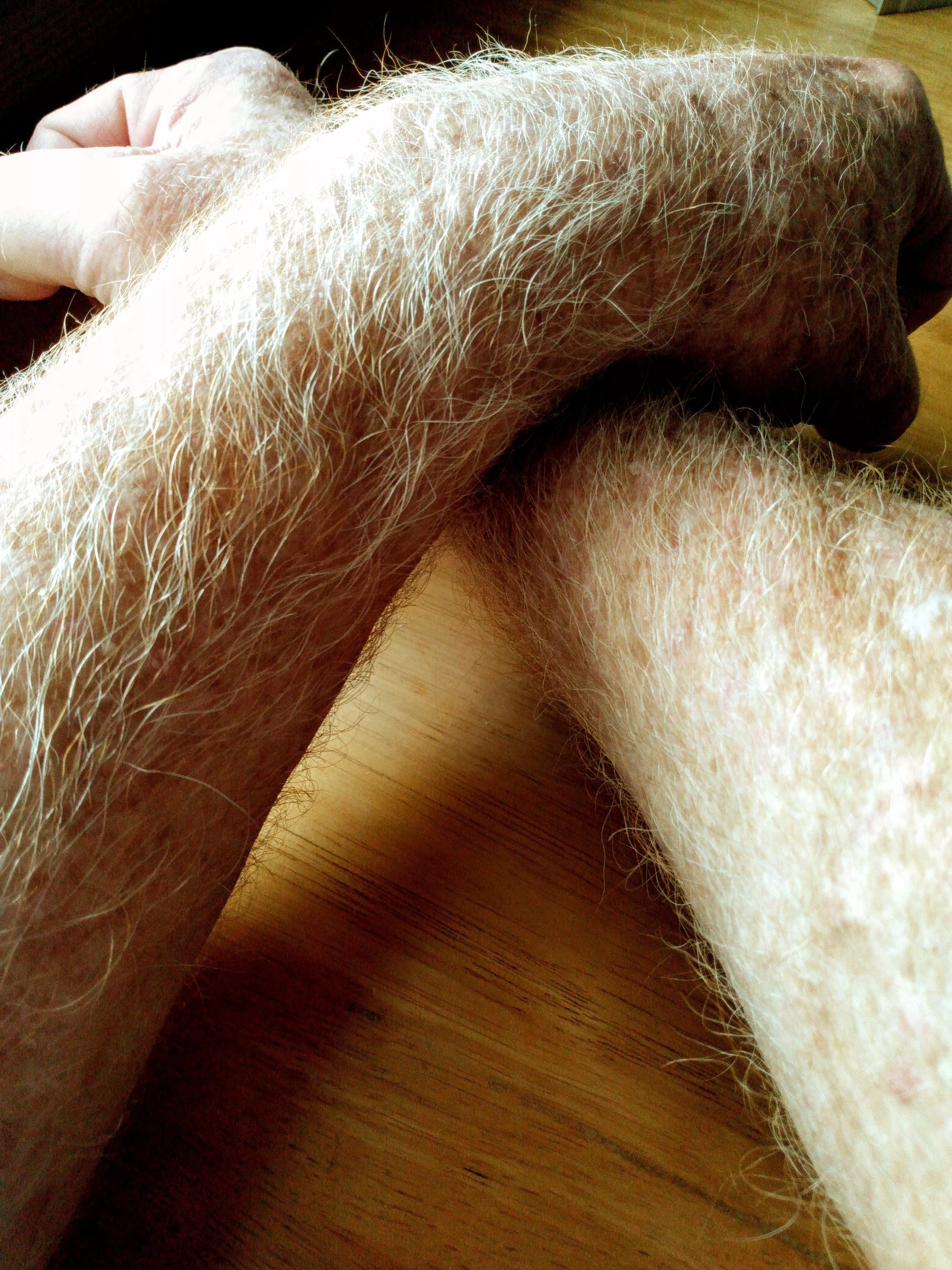 I hated being a ginger. So glad when the sun bleached it blond posted by silverbearar