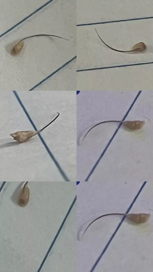 Hairy Houdini the Magic Hair Folicle by Crashoveride544