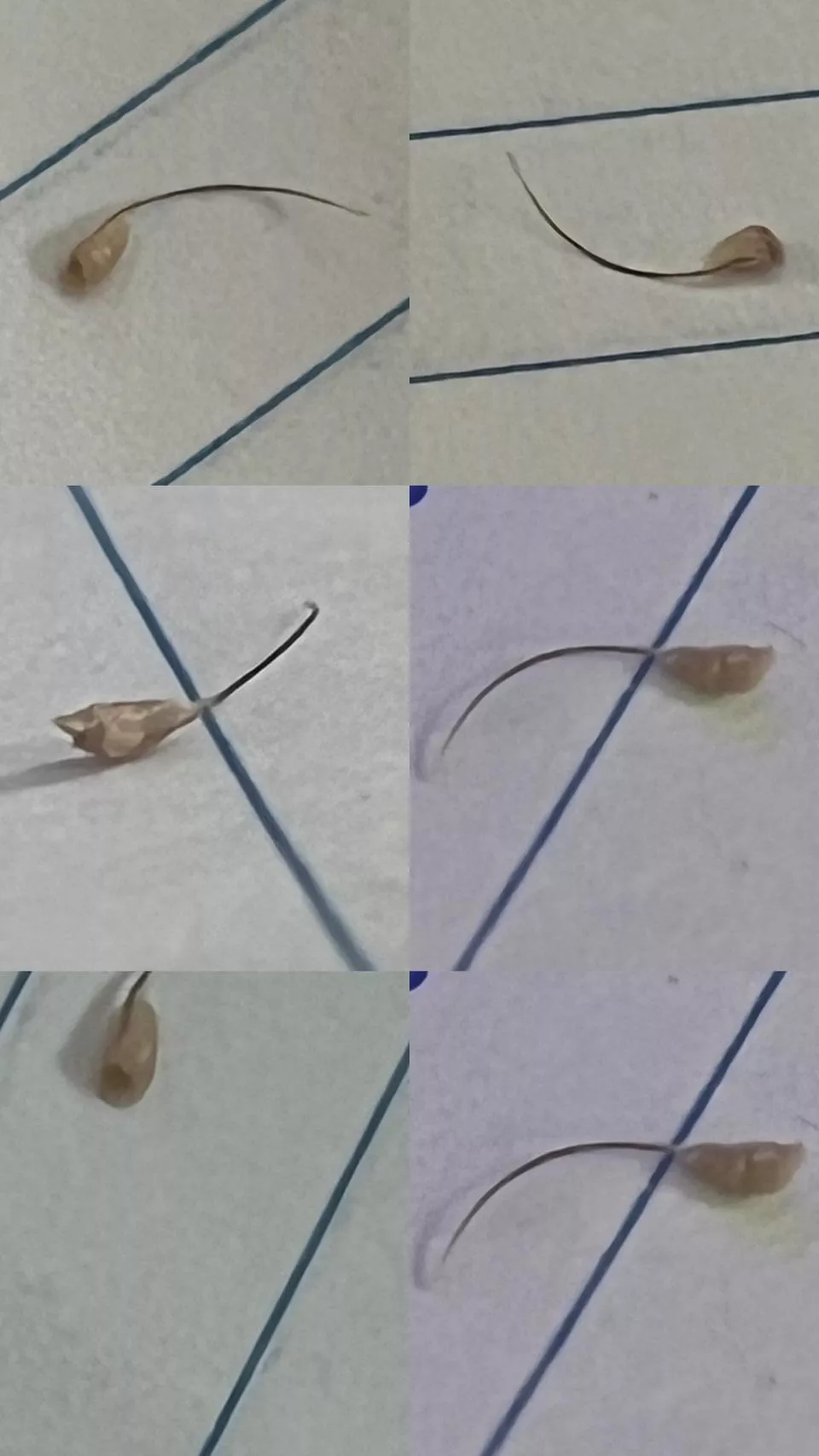 Hairy Houdini the Magic Hair Folicle posted by Crashoveride544