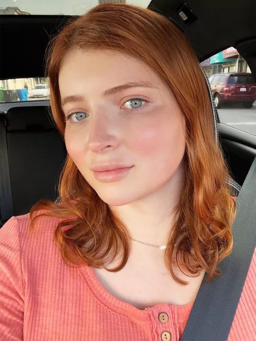 After my second filler session ever, should I go bigger? by april6055