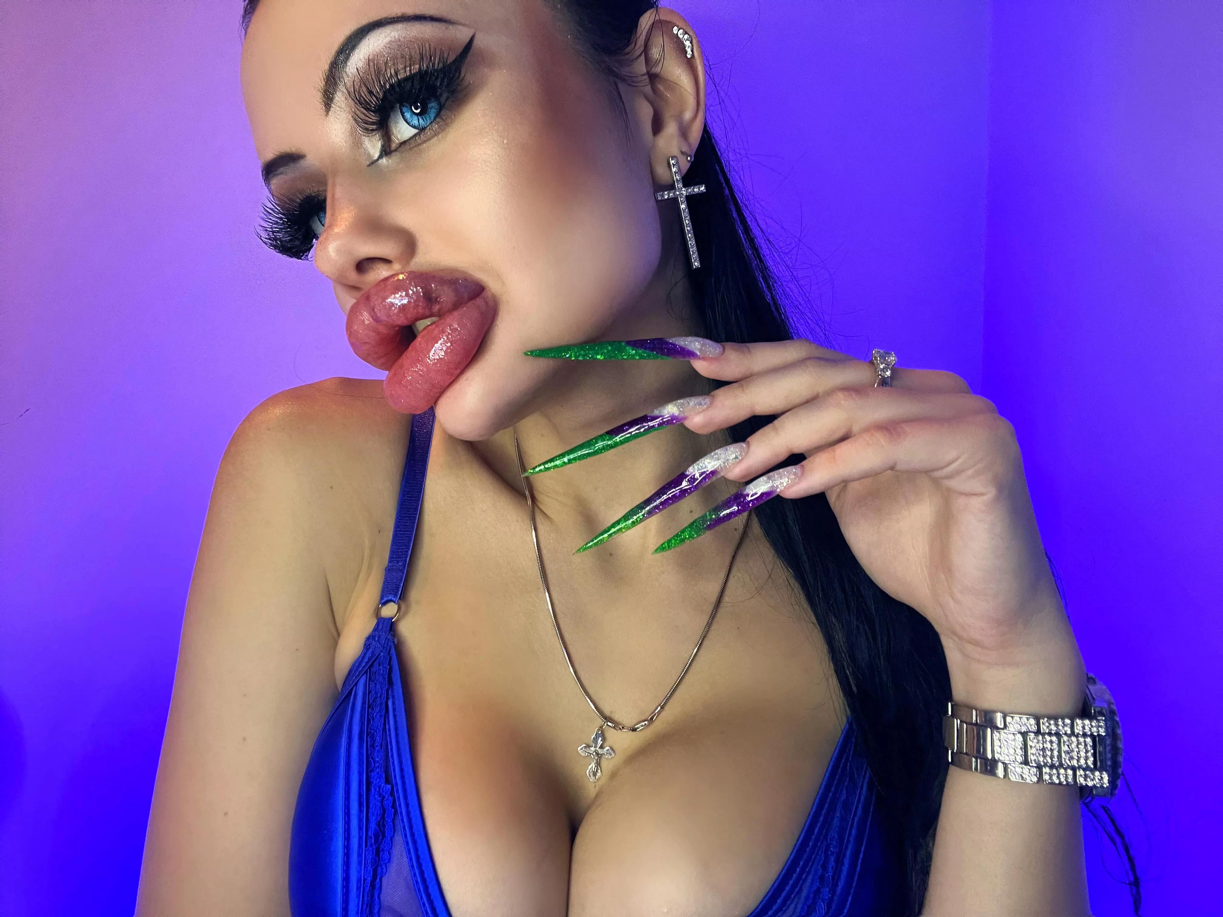 My biggest swollen lips 👄 posted by Fine-Ad2329