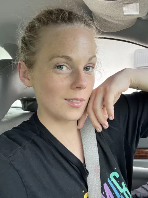 Freckles to brighten your day by Amputeelove