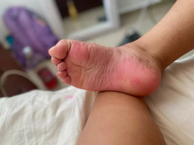 Note to self: don’t write someone’s name on my feet with markers or else I’ll have stained soles😂 by Dreafeet_