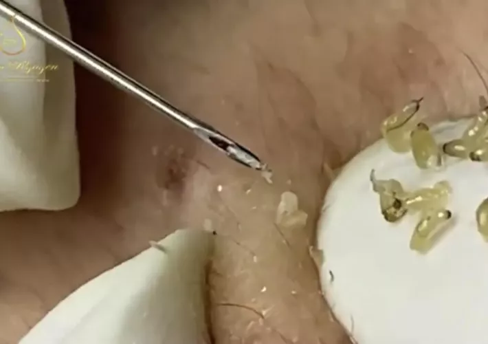 I got a fun message -- love you too blackhead 🙏🏻 by Elephantmenstruation