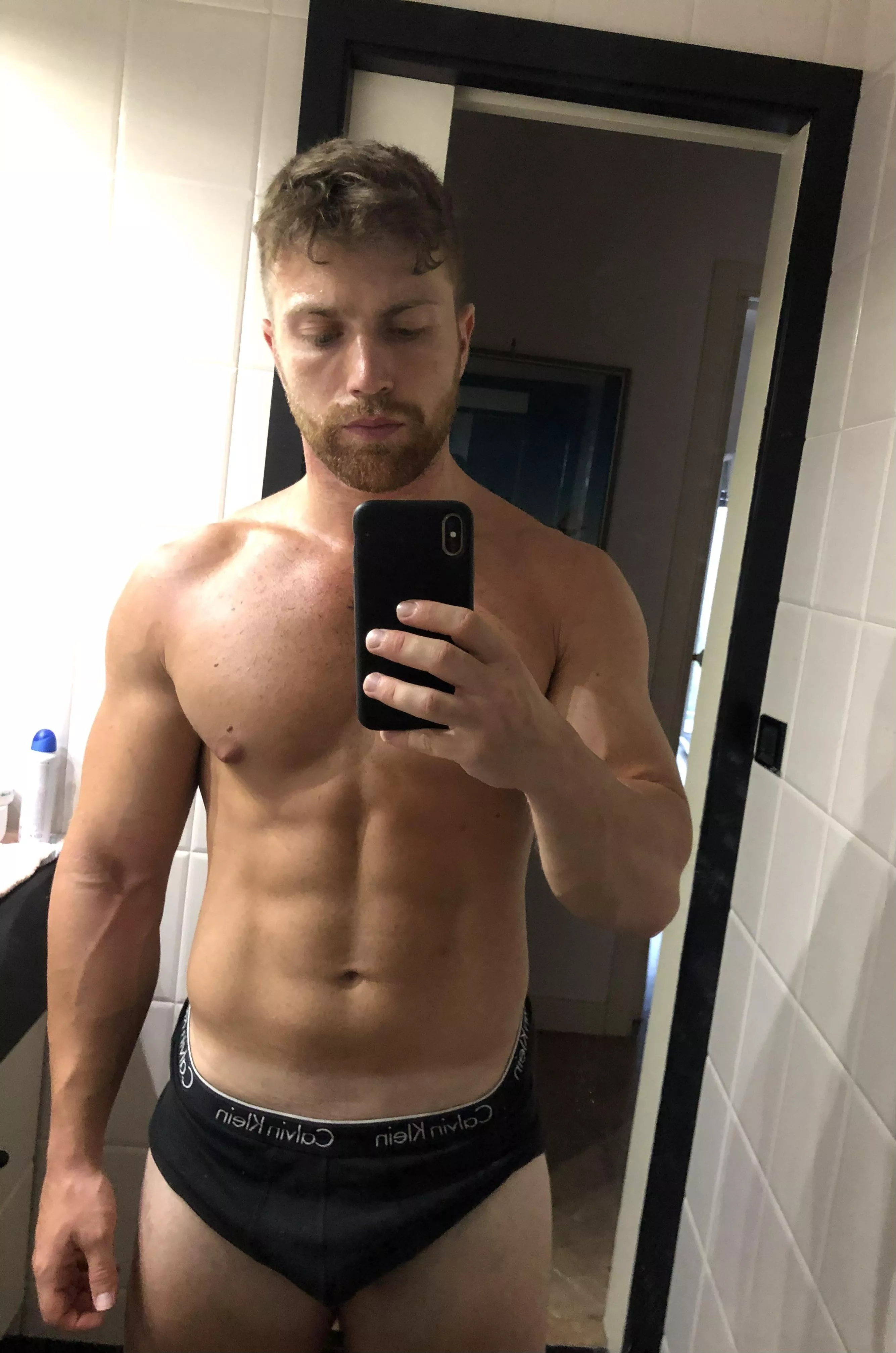 Sunburns and cks posted by yoursitalianchrus