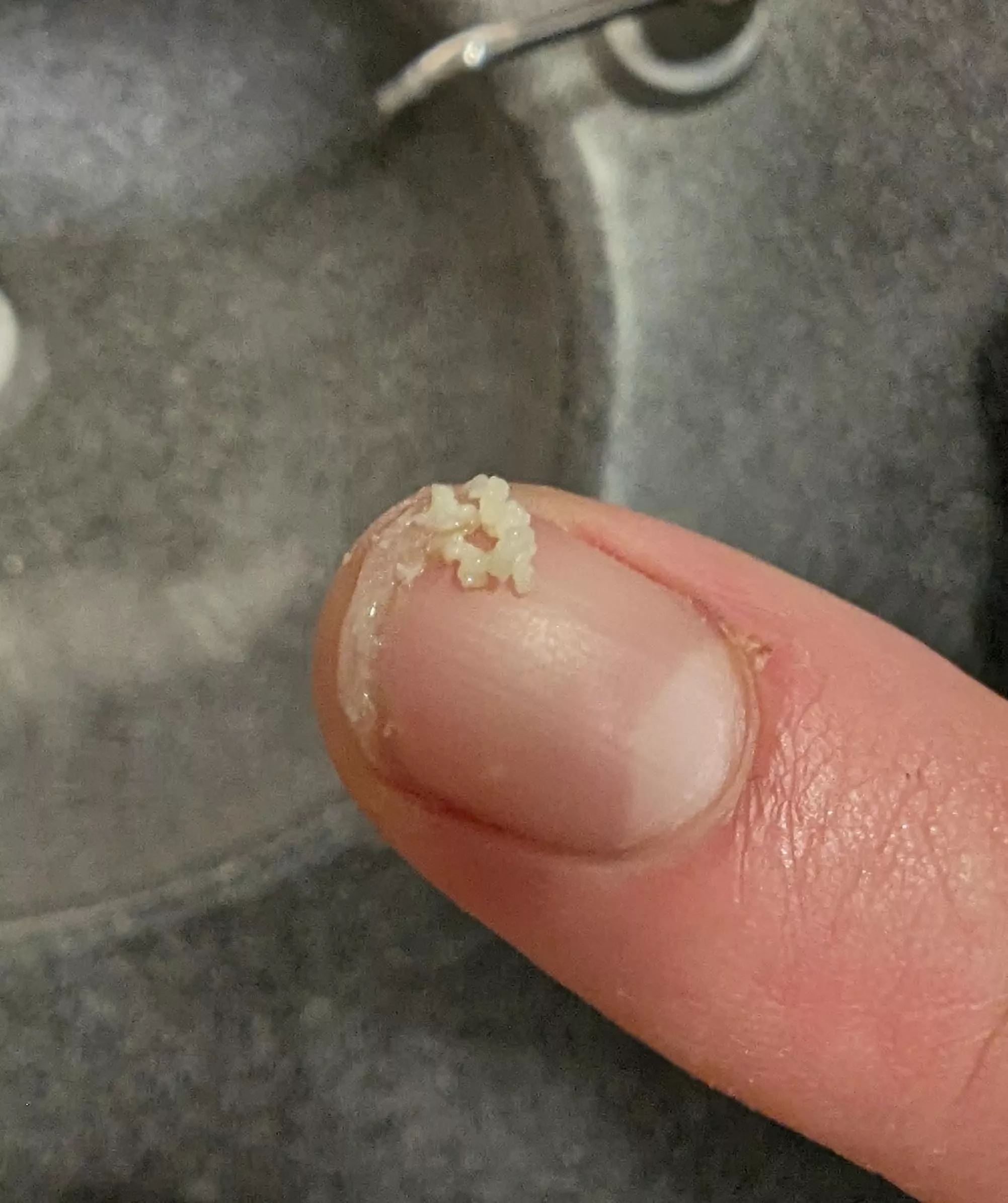 There's a pore on my cheek that fills up every couple weeks posted by romulan267