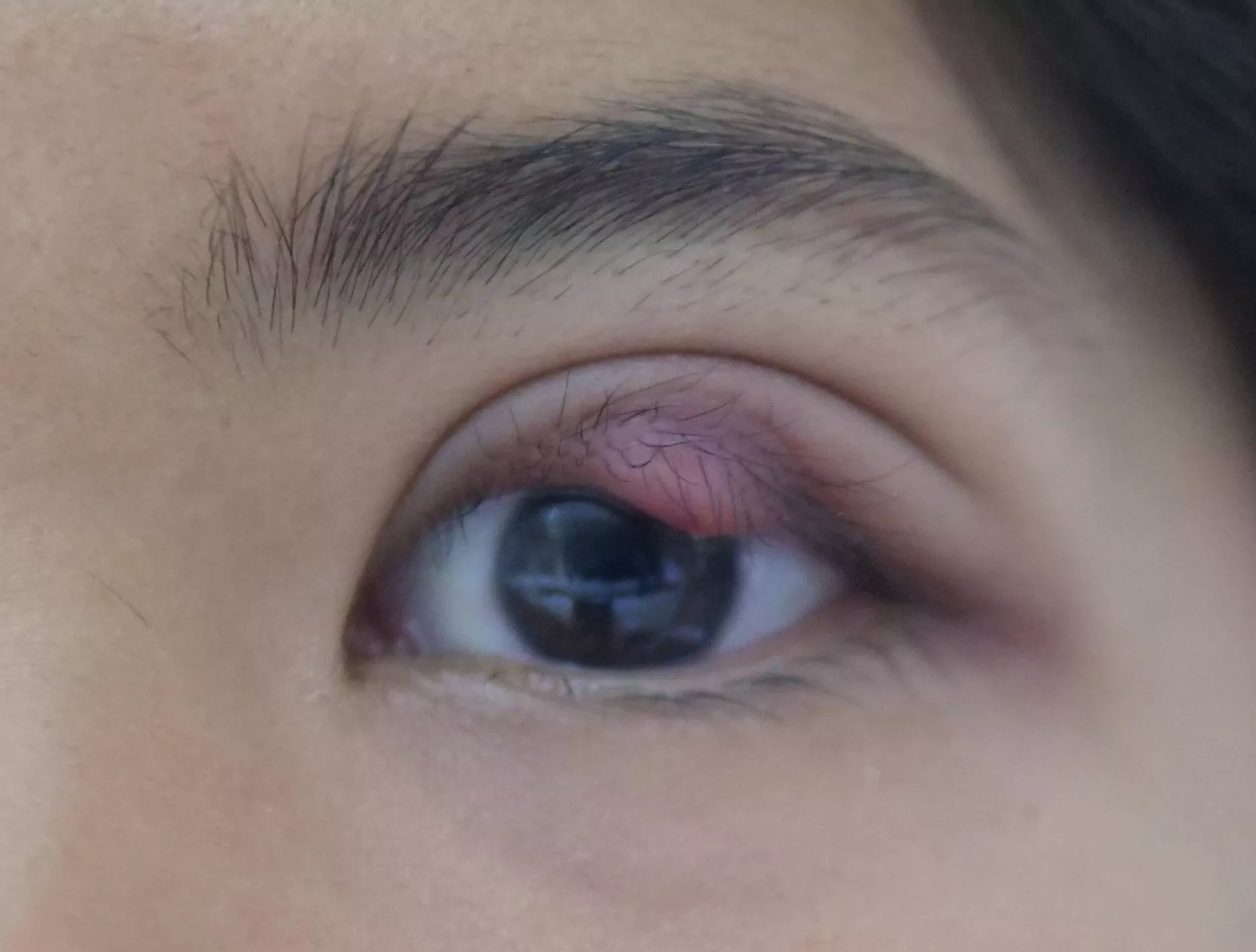 2am - tempted to pop XL stye! posted by BlaBlah_12345