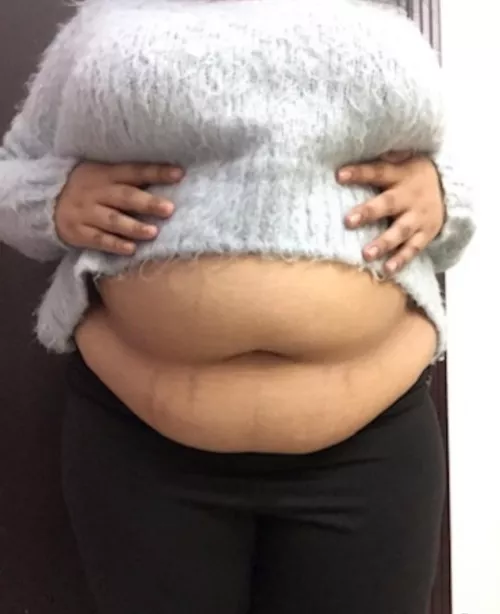 I get wet from being teased and praised about my belly 🙈 by Known-Significance26